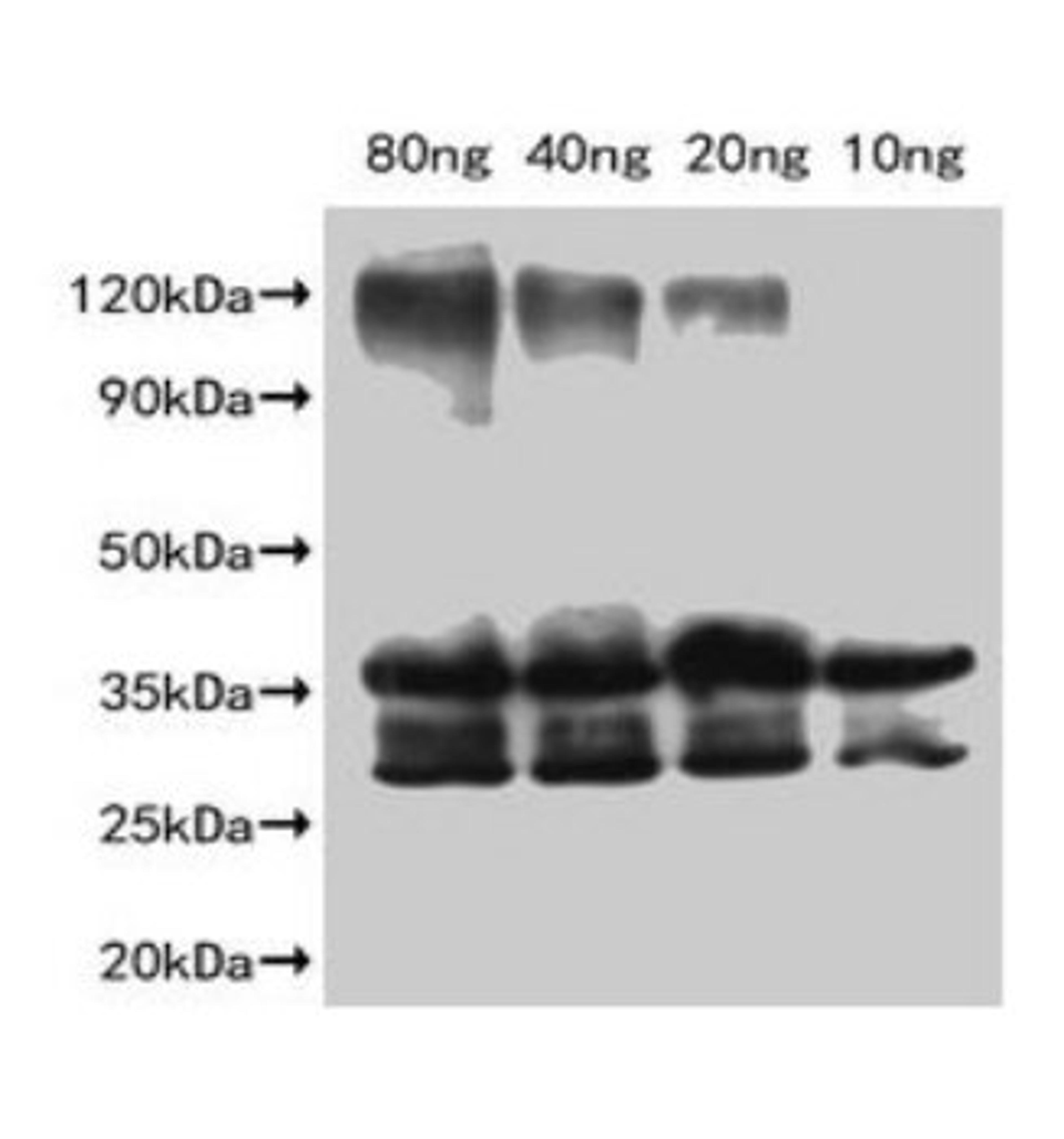 Western Blot. Positive WB detected in Recombinant protein. All lanes: Slfn9 antibody at 1:2000. Secondary. Goat polyclonal to rabbit IgG at 1/50000 dilution. Predicted band size: 36.2 kDa. Observed band size: 35 kDa.