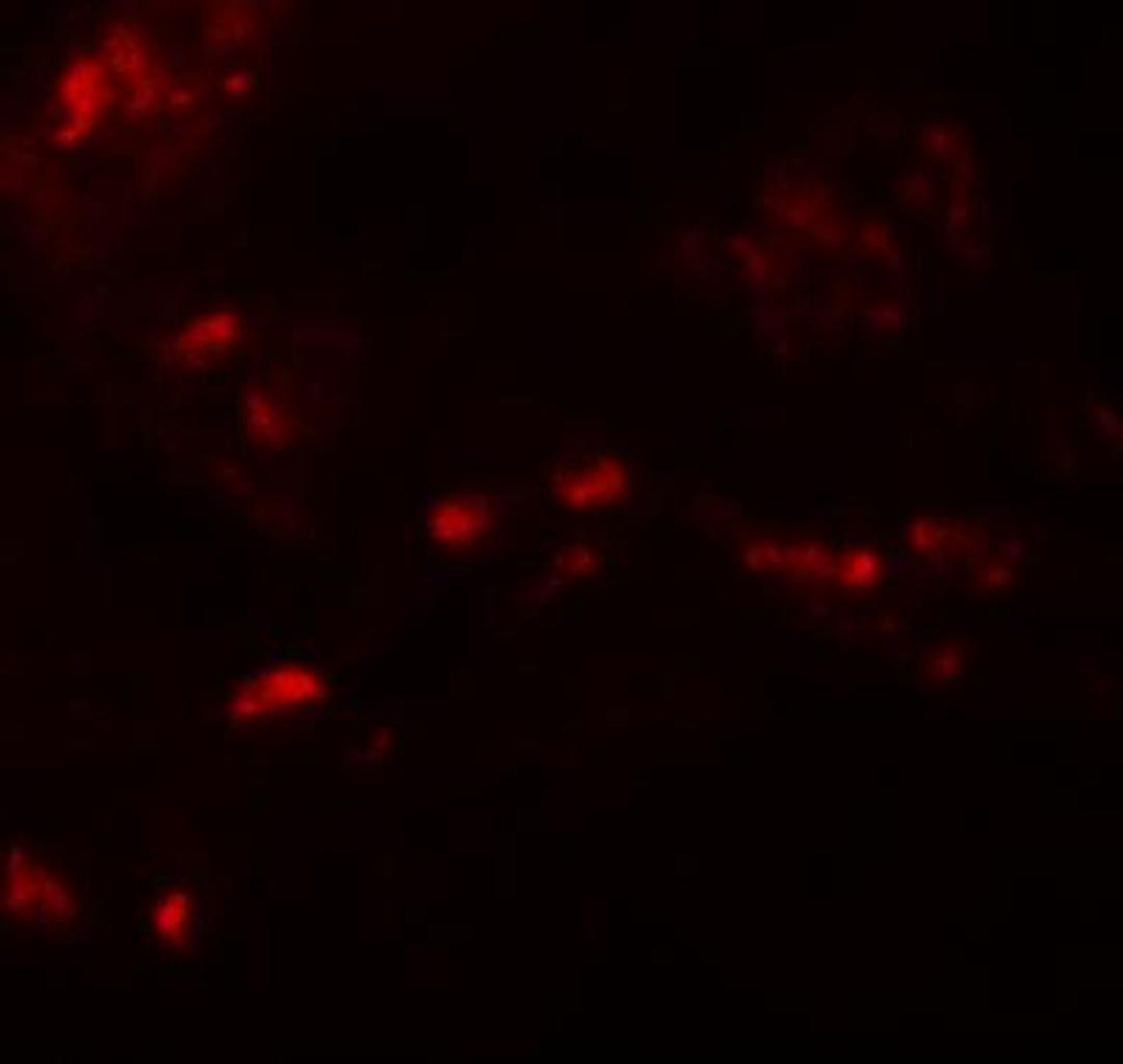 Immunocytochemistry/Immunofluorescence: SPRYD4 Antibody [NBP1-77100] - Immunofluorescence of SPRYD4 in human kidney tissue with SPRYD4 antibody at 20 ug/mL.