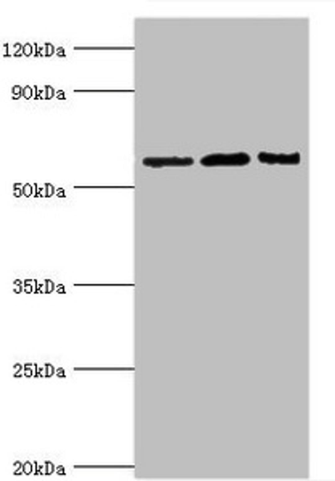 Western blot. All lanes: Interleukin-10 receptor subunit alpha antibody at 8ug/ml. Lane 1: Mouse heart tissue. Lane 2: Hela whole cell lysate. Lane 3: Mouse liver tissue. Secondary. Goat polyclonal to rabbit IgG at 1/10000 dilution. Predicted band size: 63 kDa. Observed band size: 63 kDa. 