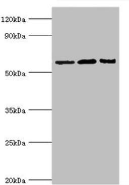 Western blot. All lanes: Interleukin-10 receptor subunit alpha antibody at 8ug/ml. Lane 1: Mouse heart tissue. Lane 2: Hela whole cell lysate. Lane 3: Mouse liver tissue. Secondary. Goat polyclonal to rabbit IgG at 1/10000 dilution. Predicted band size: 63 kDa. Observed band size: 63 kDa. 