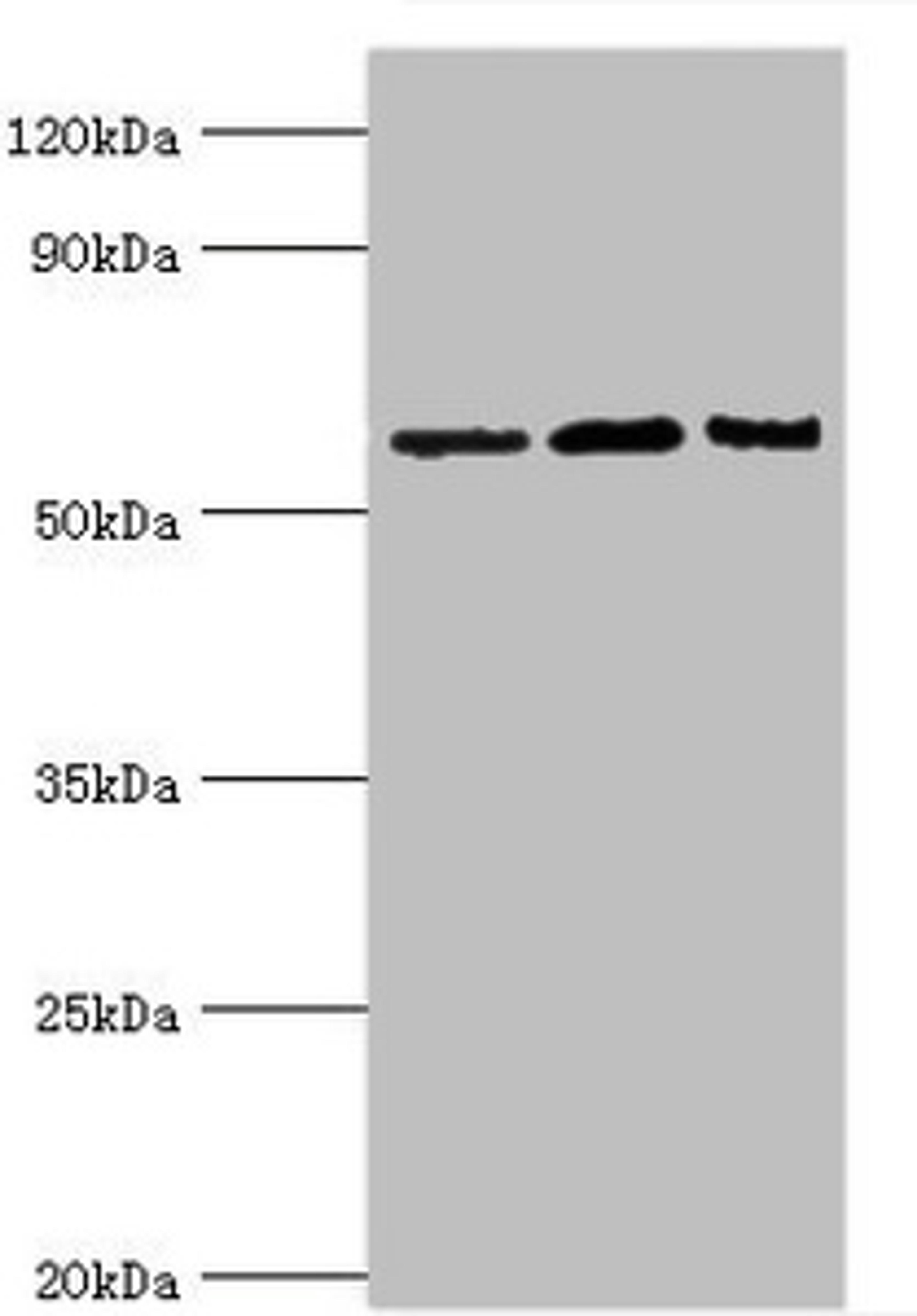Western blot. All lanes: Interleukin-10 receptor subunit alpha antibody at 8ug/ml. Lane 1: Mouse heart tissue. Lane 2: Hela whole cell lysate. Lane 3: Mouse liver tissue. Secondary. Goat polyclonal to rabbit IgG at 1/10000 dilution. Predicted band size: 63 kDa. Observed band size: 63 kDa. 