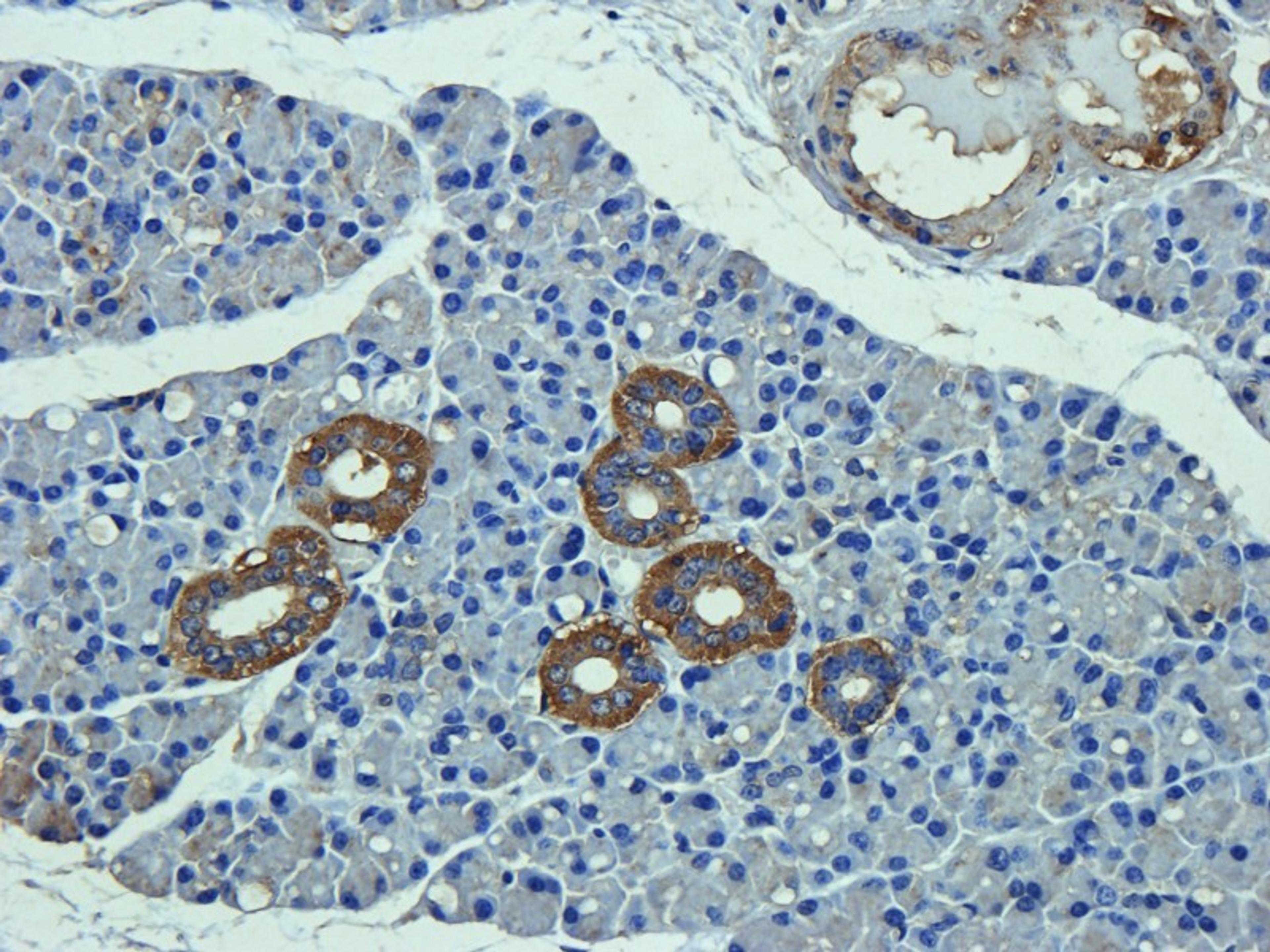 IHC-P image of mouse lymph node tissue using anti-C1R (dilution of primary antibody at 2.5 ug/ml)