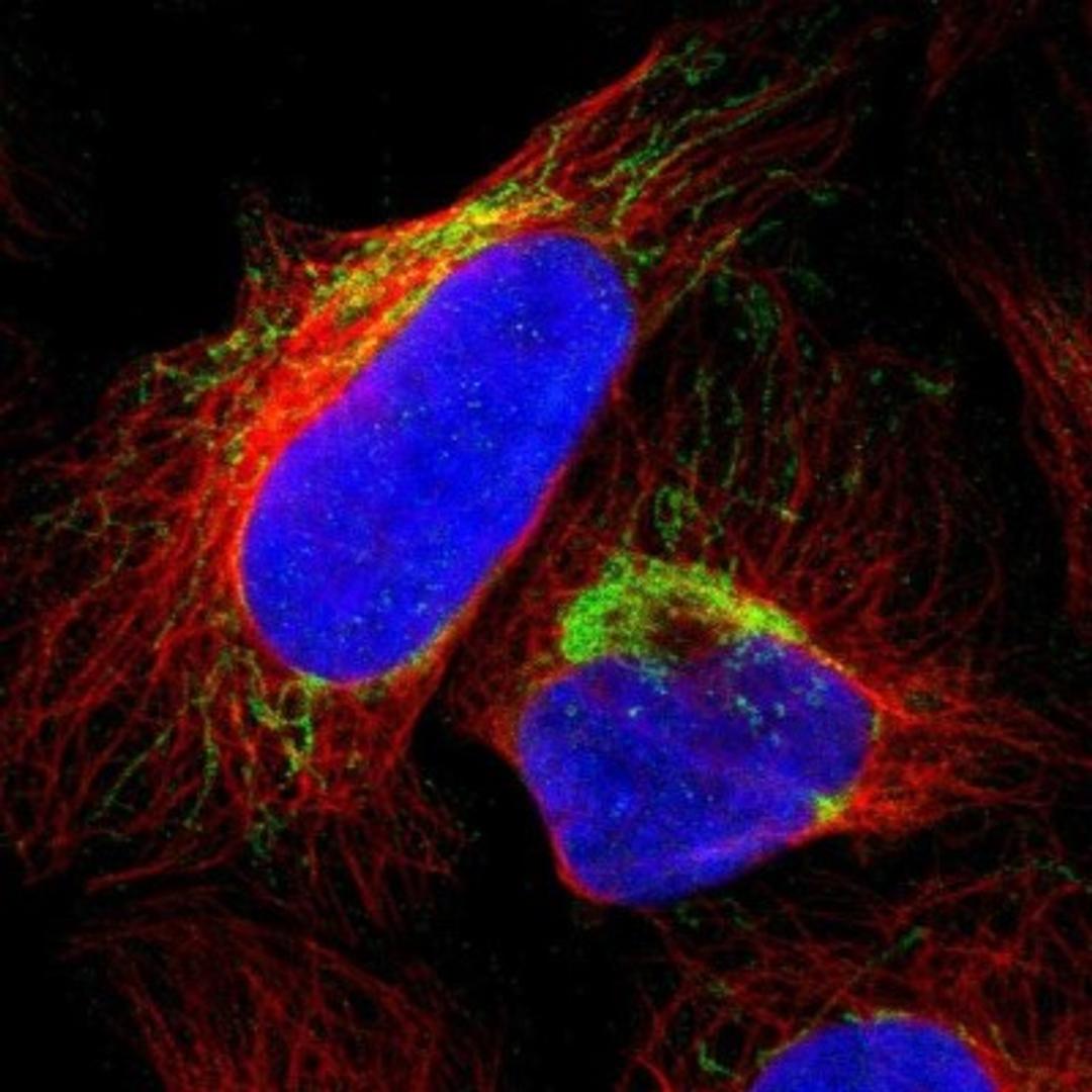 Immunocytochemistry/Immunofluorescence: calcium homeostasis modulator 2 Antibody [NBP1-87936] - Staining of human cell line U-2 OS shows positivity in mitochondria.