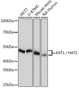 Western blot - KAT1 / HAT1 Rabbit mAb (A4423)