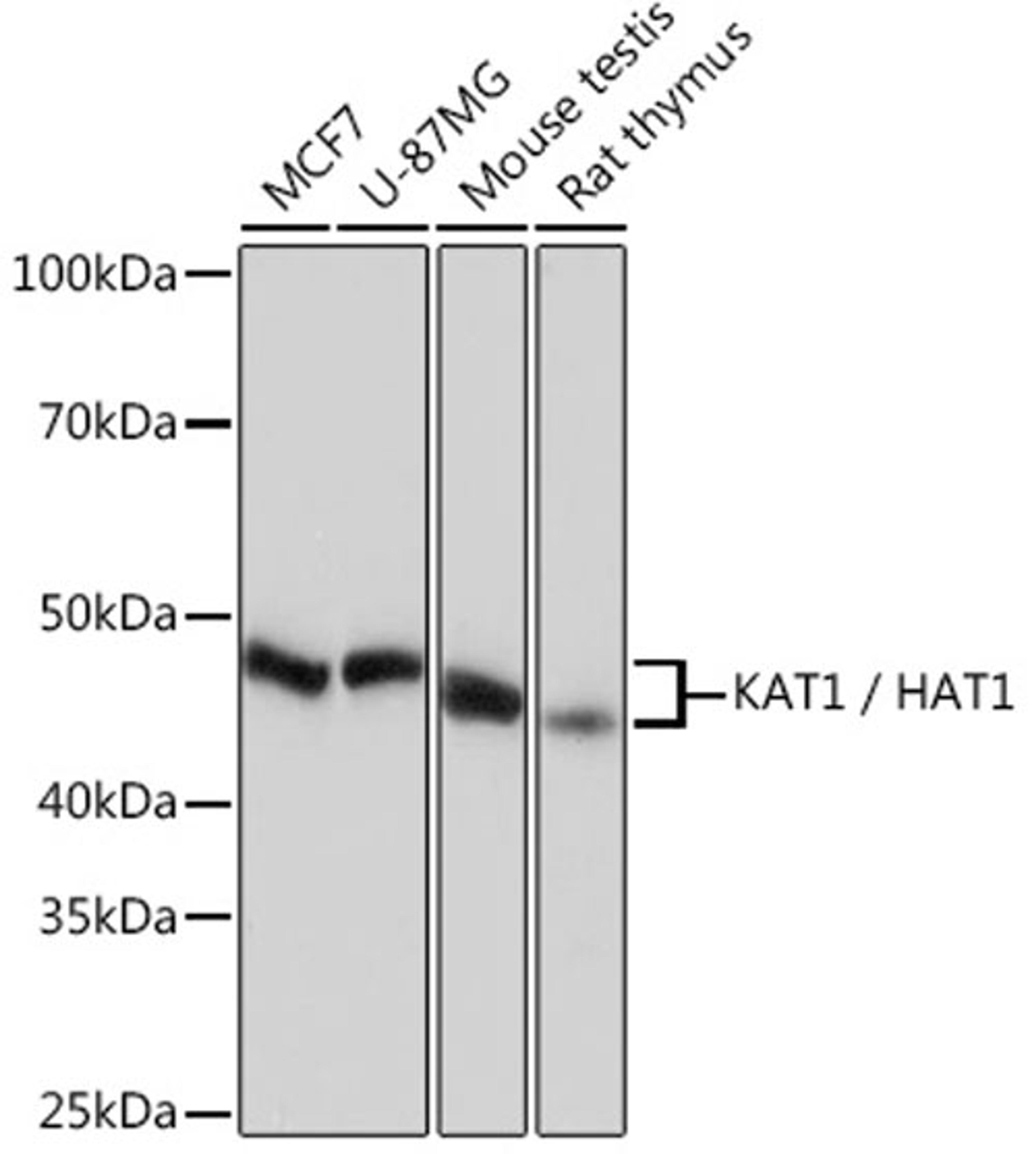 Western blot - KAT1 / HAT1 Rabbit mAb (A4423)