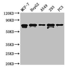 Western Blot. Positive WB detected in: MCF-7 whole cell lysate, HepG2 whole cell lysate, A549 whole cell lysate, 293 whole cell lysate, PC-3 whole cell lysate. All lanes: MAGED2 antibody at 4.5µg/ml. Secondary. Goat polyclonal to rabbit IgG at 1/50000 dilution. Predicted band size: 65, 64 kDa. Observed band size: 65, 64 kDa