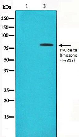 Western blot analysis of HepG2 whole cell lysates using PKC delta (Phospho-Tyr313) antibody, The lane on the left is treated with the antigen-specific peptide.