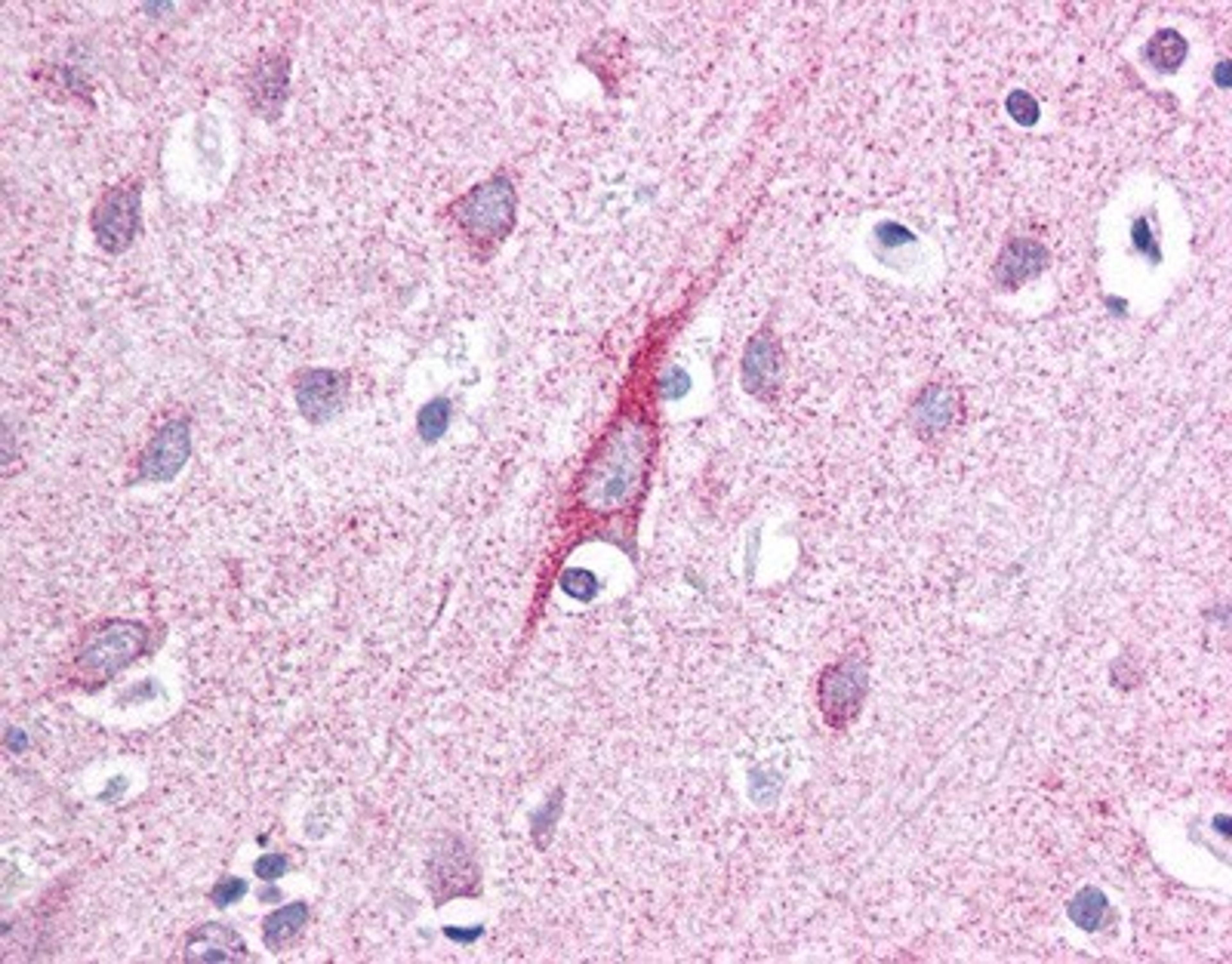 Immunohistochemistry: ATP13A2 Antibody [NB110-41486] - Staining of neurons and neuropils using a concentration of 10ug/ml.  Human brain, 40X.