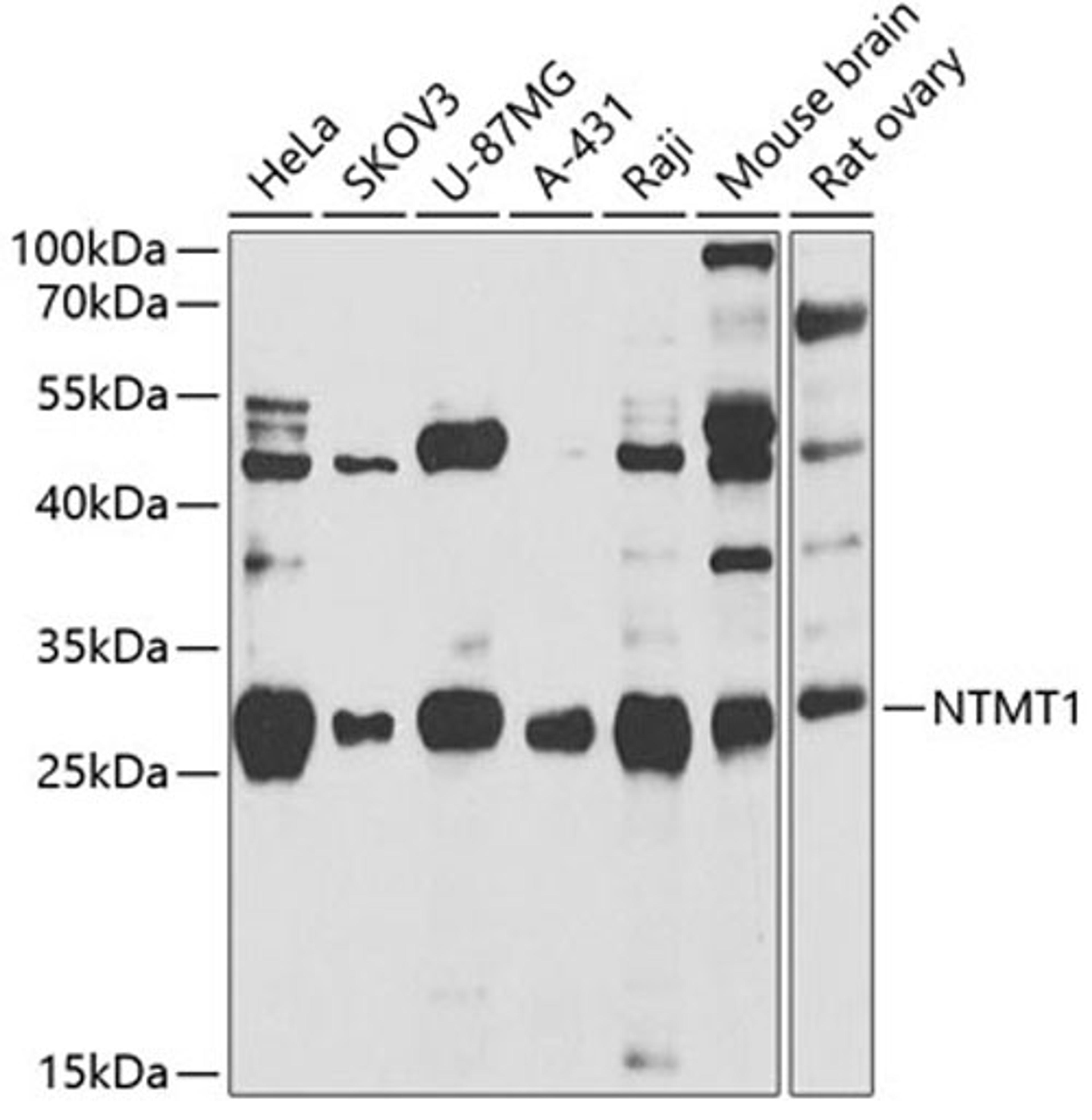 Western blot - NTMT1 antibody (A7098)