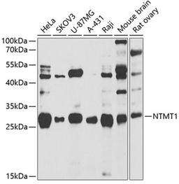 Western blot - NTMT1 antibody (A7098)