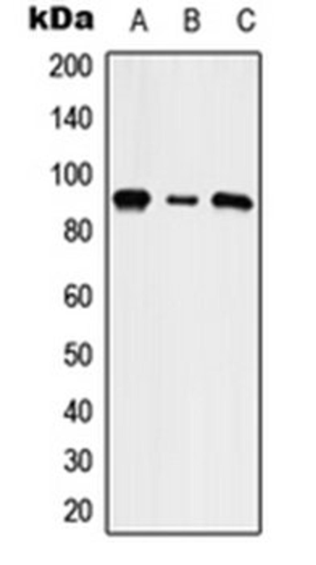 Western blot analysis of HepG2 (Lane 1), NIH3T3 (Lane 2), rat brain (Lane 3) whole cell lysates using SLC9A5 antibody