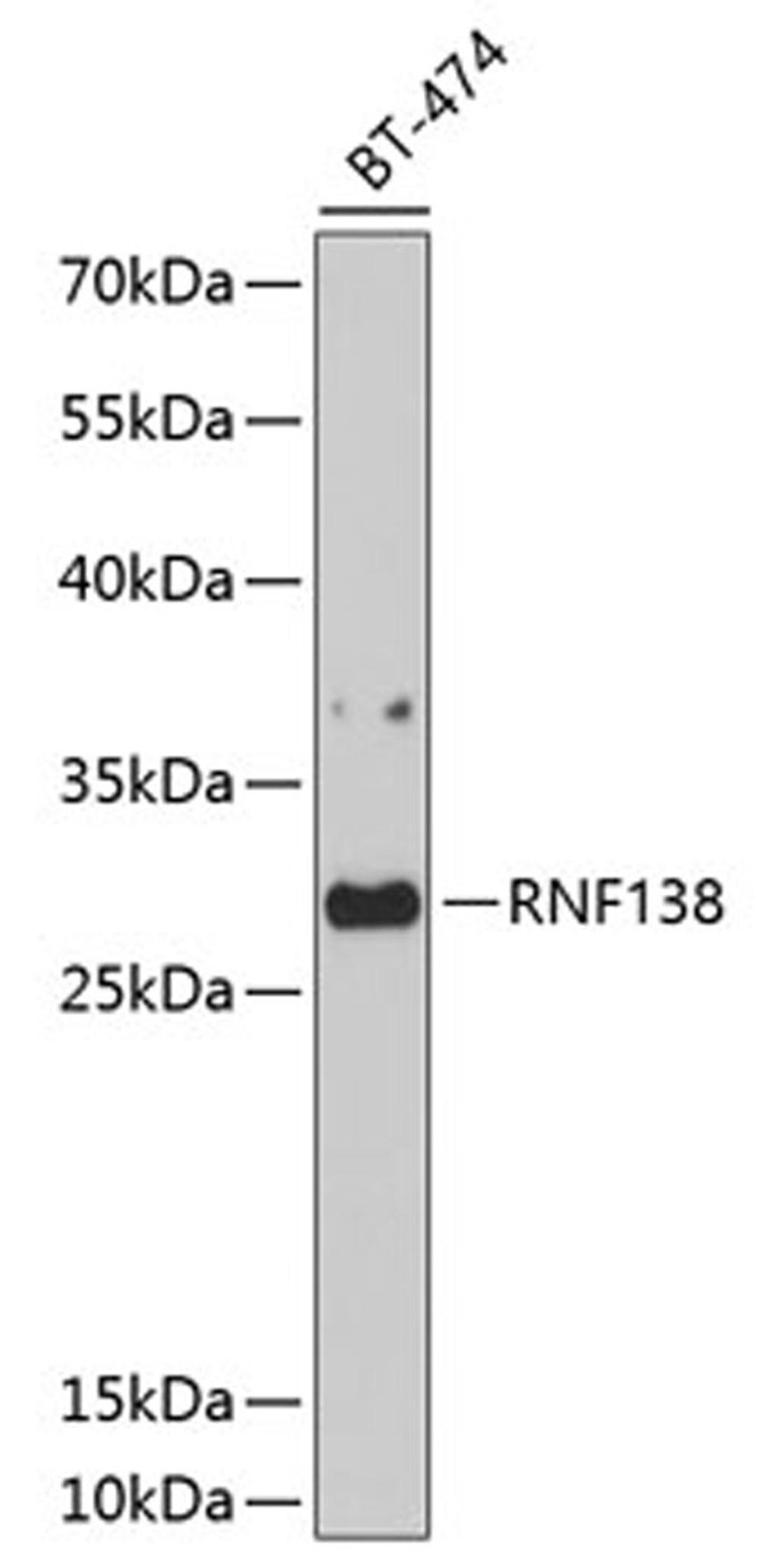 Western blot - RNF138 antibody (A10304)