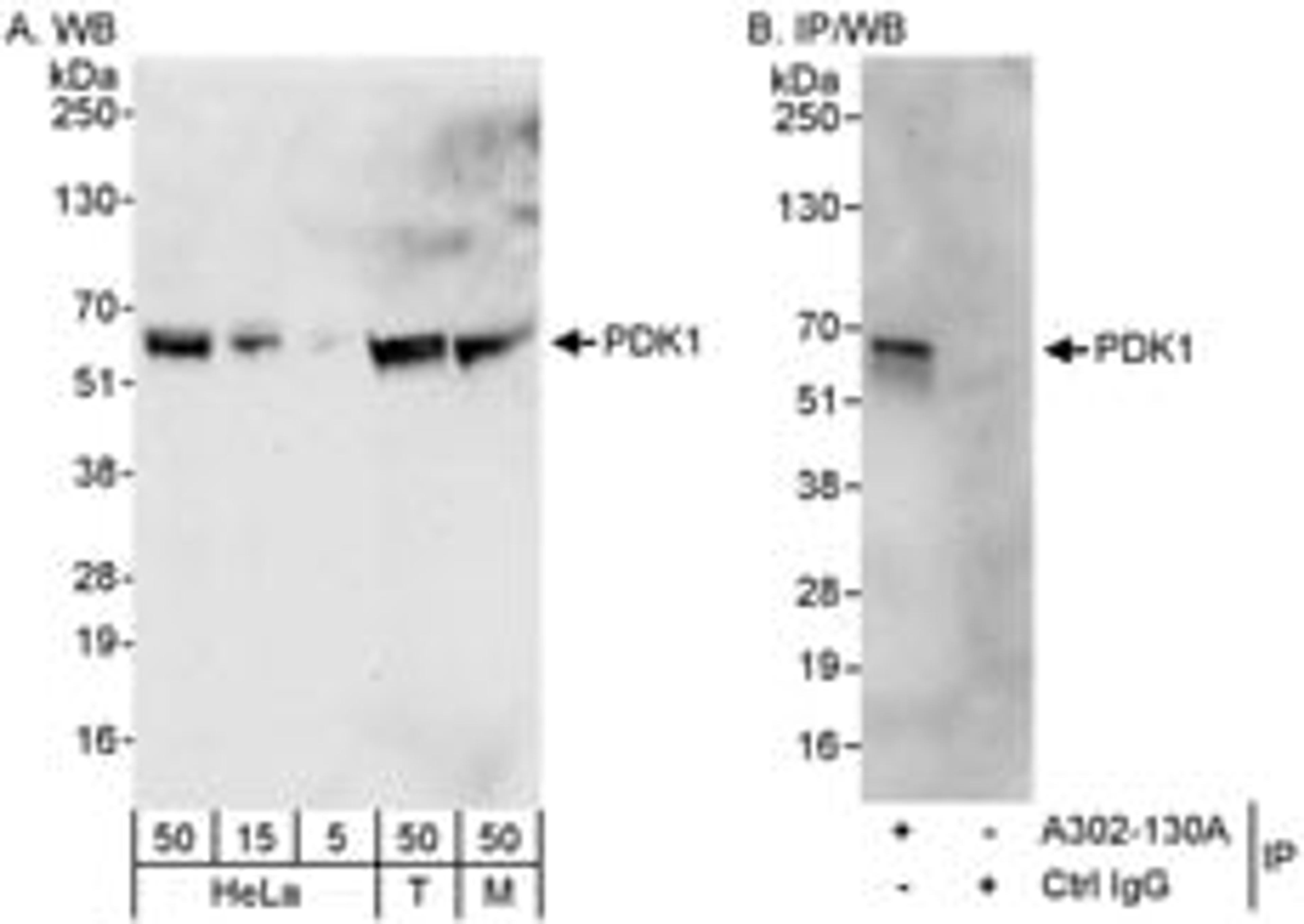 Detection of human and mouse PDK1 by western blot (h&m) and immunoprecipitation (h).