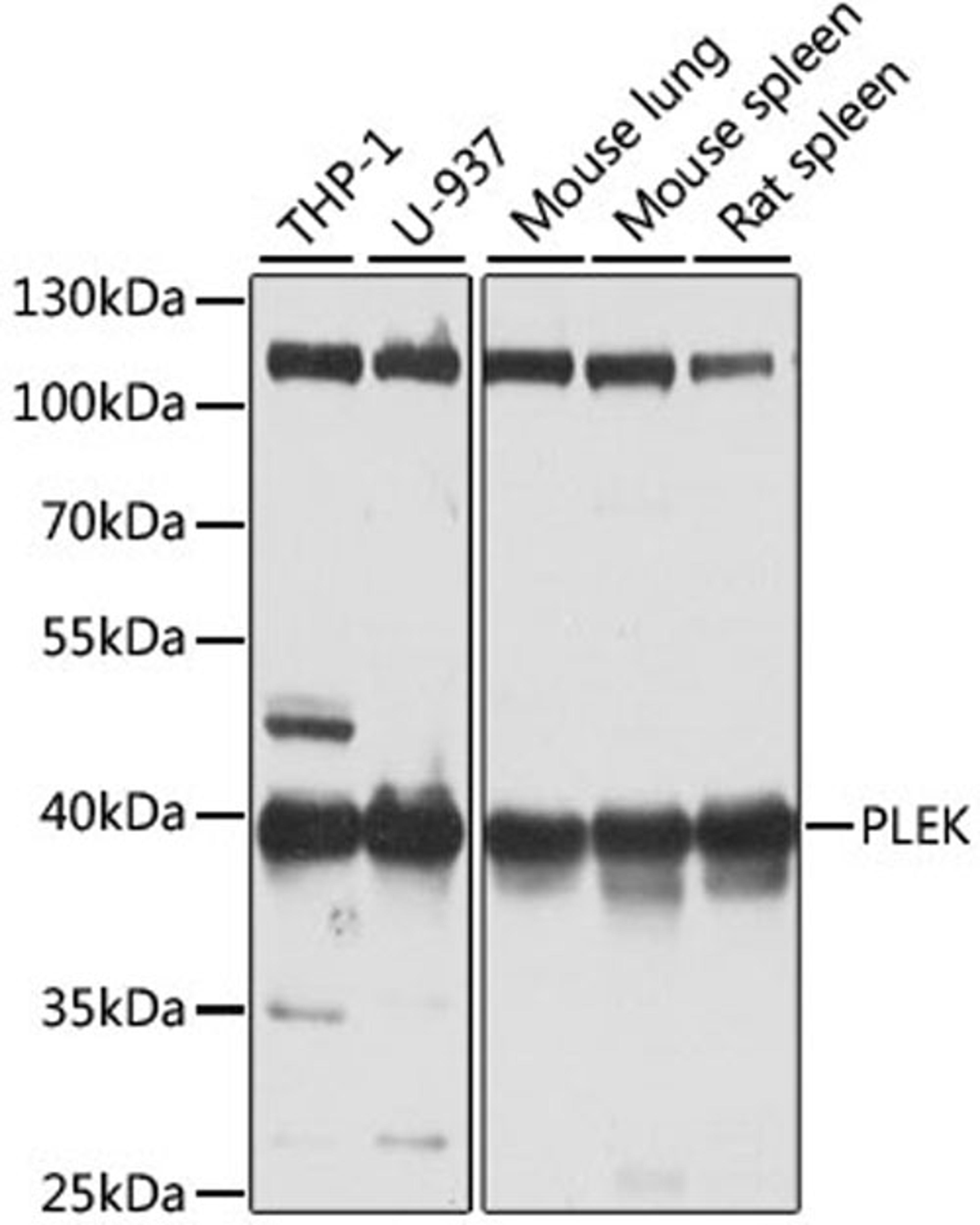 Western blot - PLEK antibody (A6305)