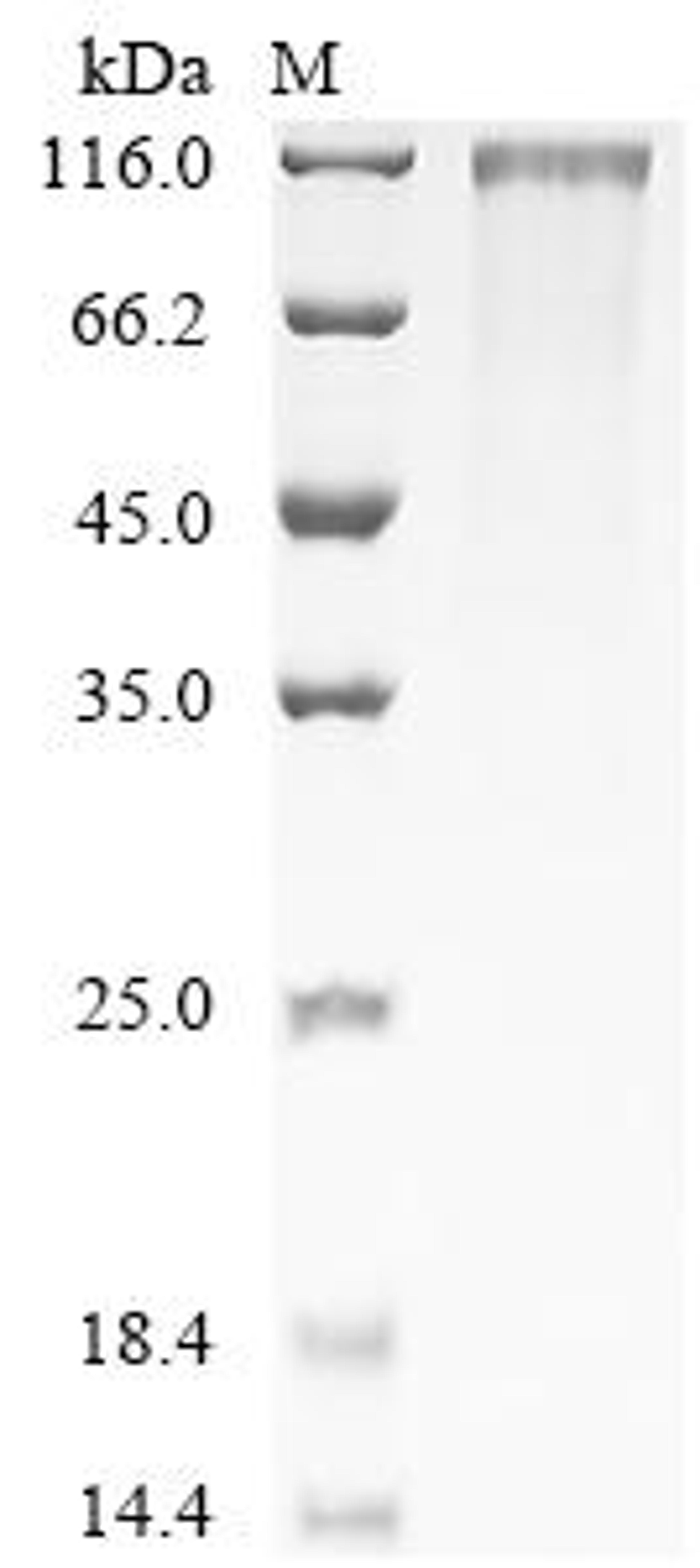 (Tris-Glycine gel) Discontinuous SDS-PAGE (reduced) with 5% enrichment gel and 15% separation gel.