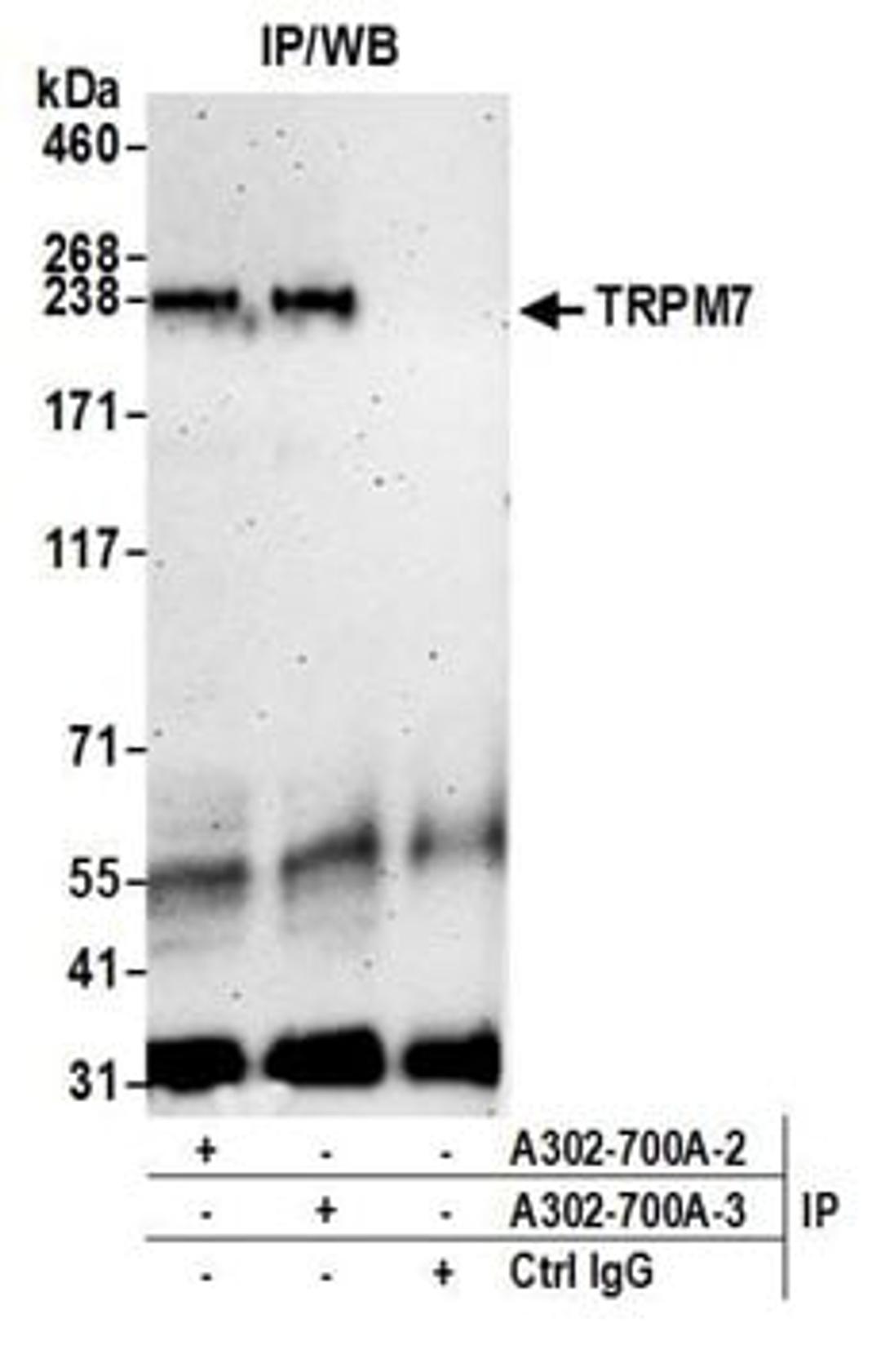 Detection of human TRPM7 by western blot of immunoprecipitates.