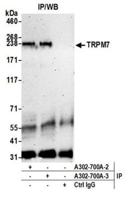 Detection of human TRPM7 by western blot of immunoprecipitates.