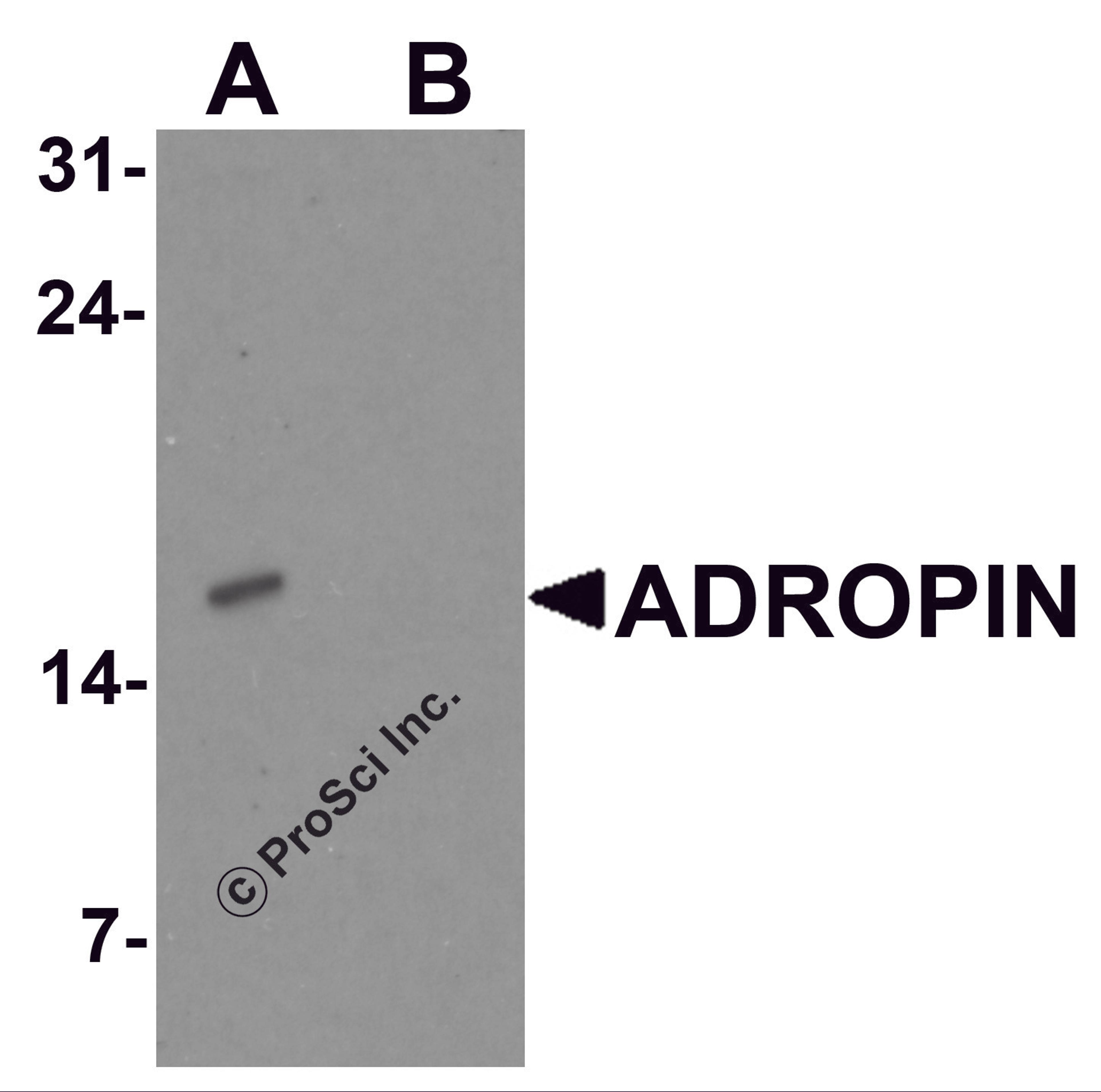 Western blot analysis of ADROPIN in human brain tissue lysate with ADROPIN antibody at 2 μg/ml in (A) the absence and (B) the presence of blocking peptide.