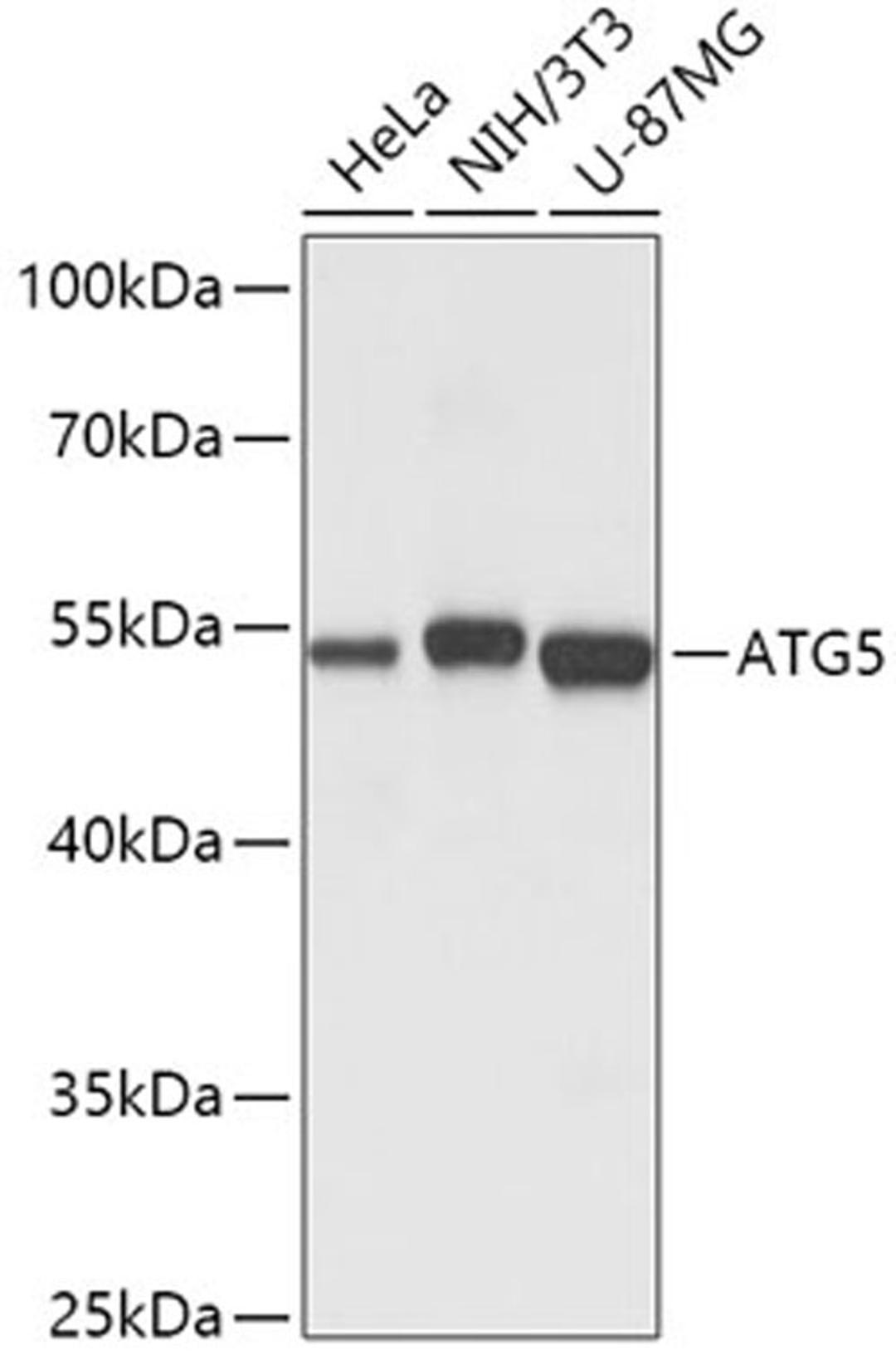 Western blot - ATG5 antibody (A0203)