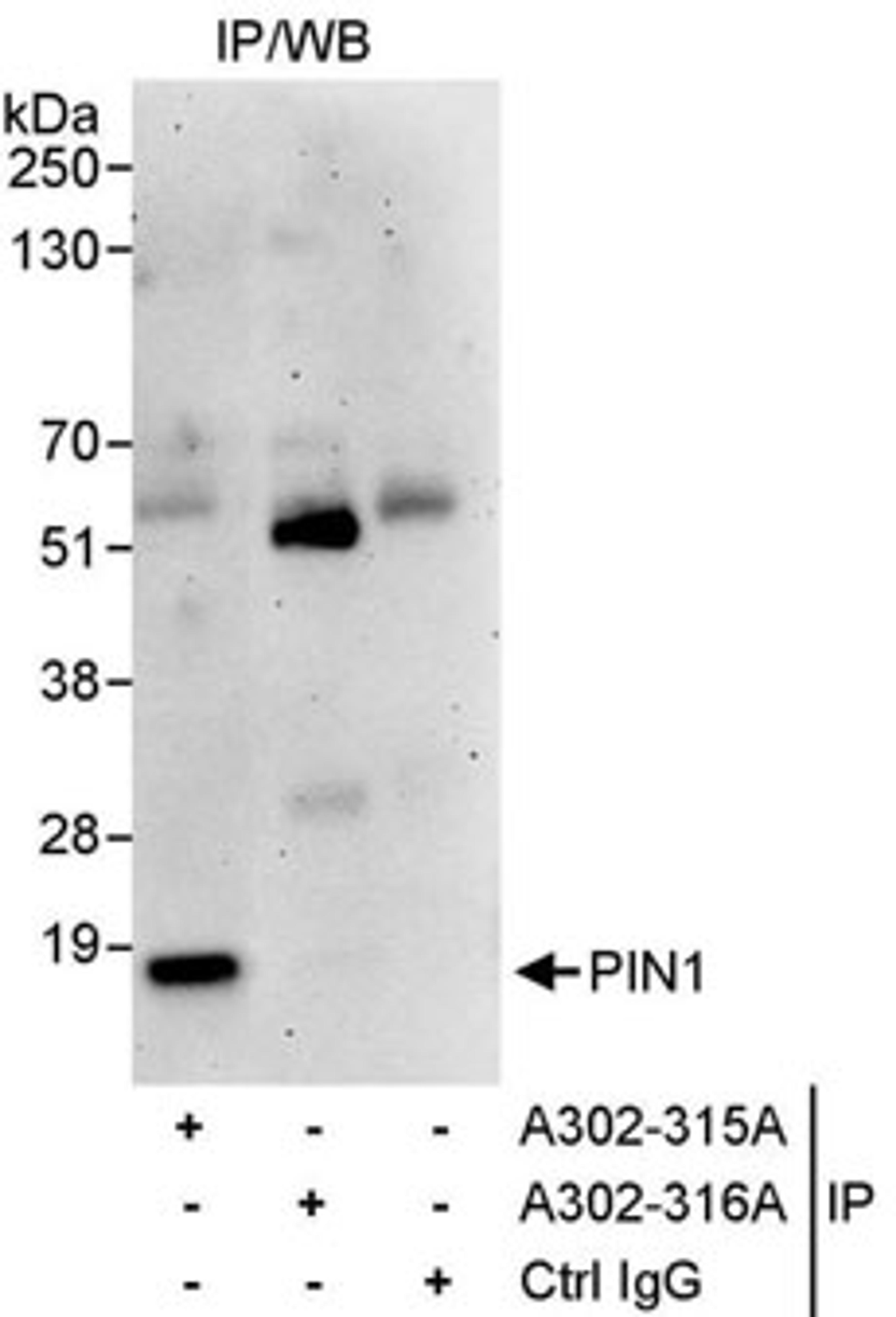 Detection of human PIN1 by western blot of immunoprecipitates.