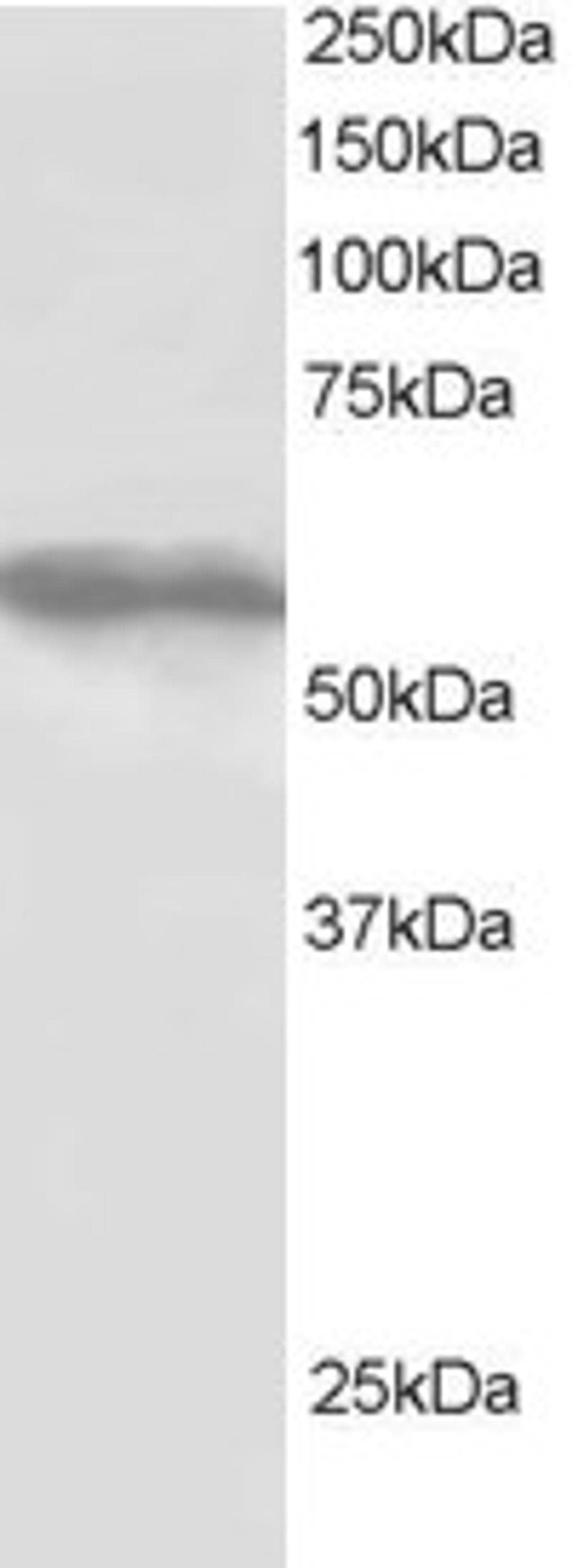 46-525 staining (1ug/ml) of HepG2 lysate (RIPA buffer, 30ug total protein per lane). Primary incubated for 1 hour. Detected by western blot using chemiluminescence.