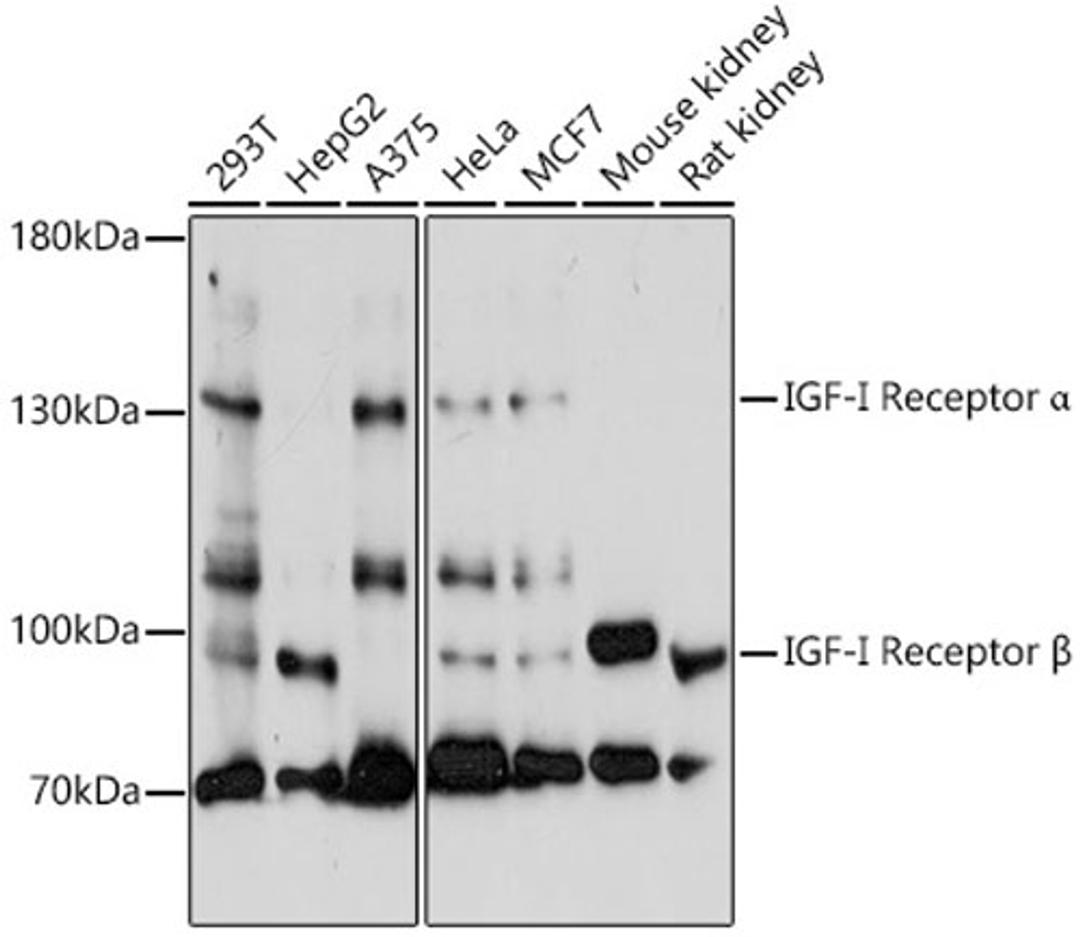 Western blot - IGF1R antibody (A0243)