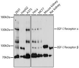 Western blot - IGF1R antibody (A0243)