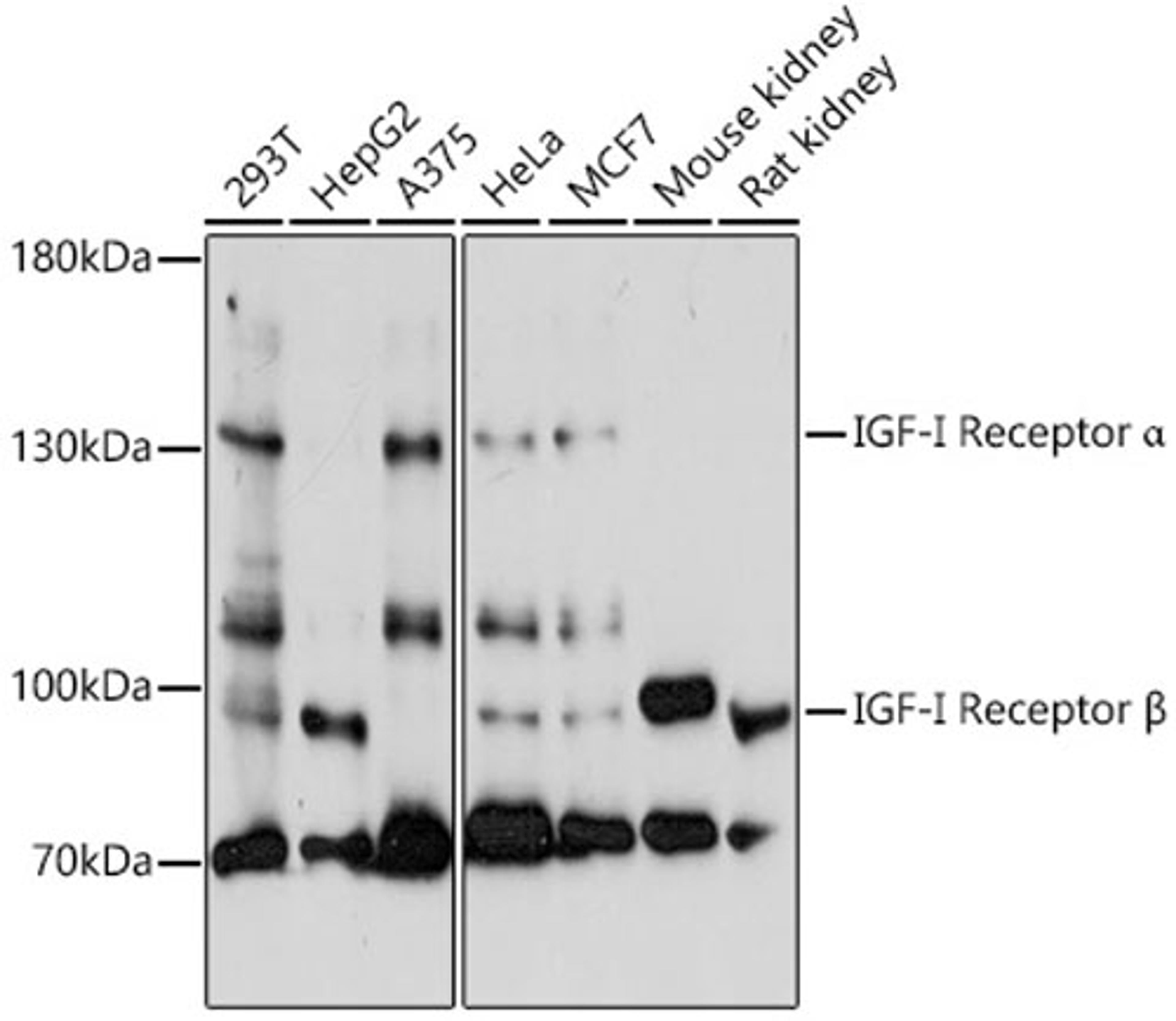 Western blot - IGF1R antibody (A0243)