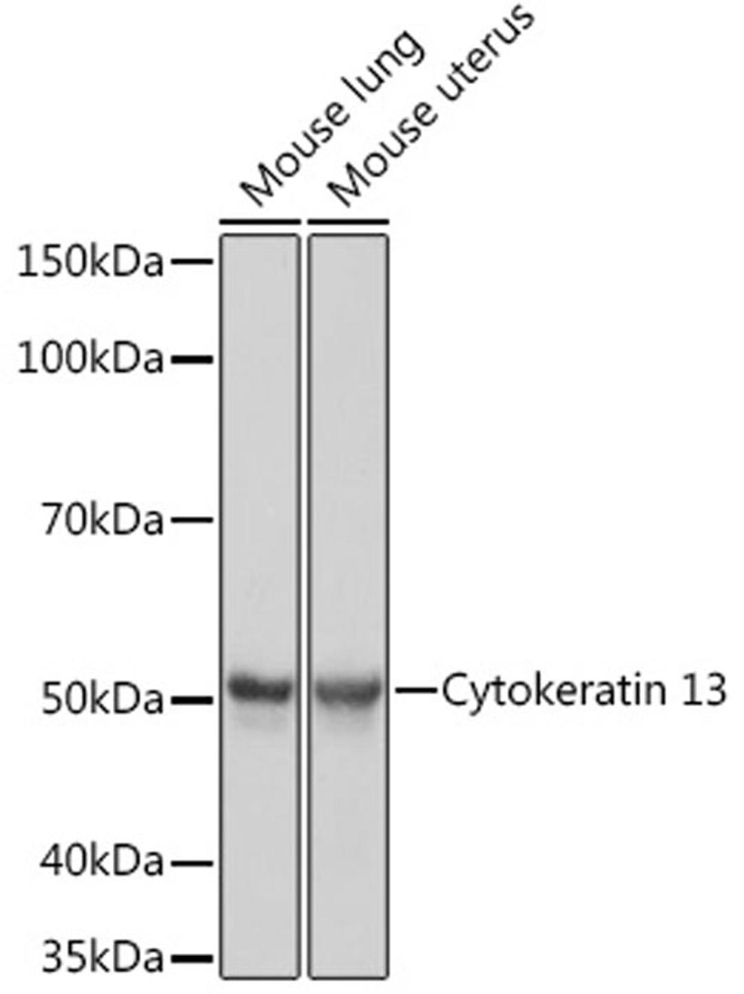 Western blot - Cytokeratin 13 Rabbit mAb (A0411)