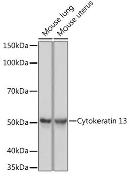 Western blot - Cytokeratin 13 Rabbit mAb (A0411)