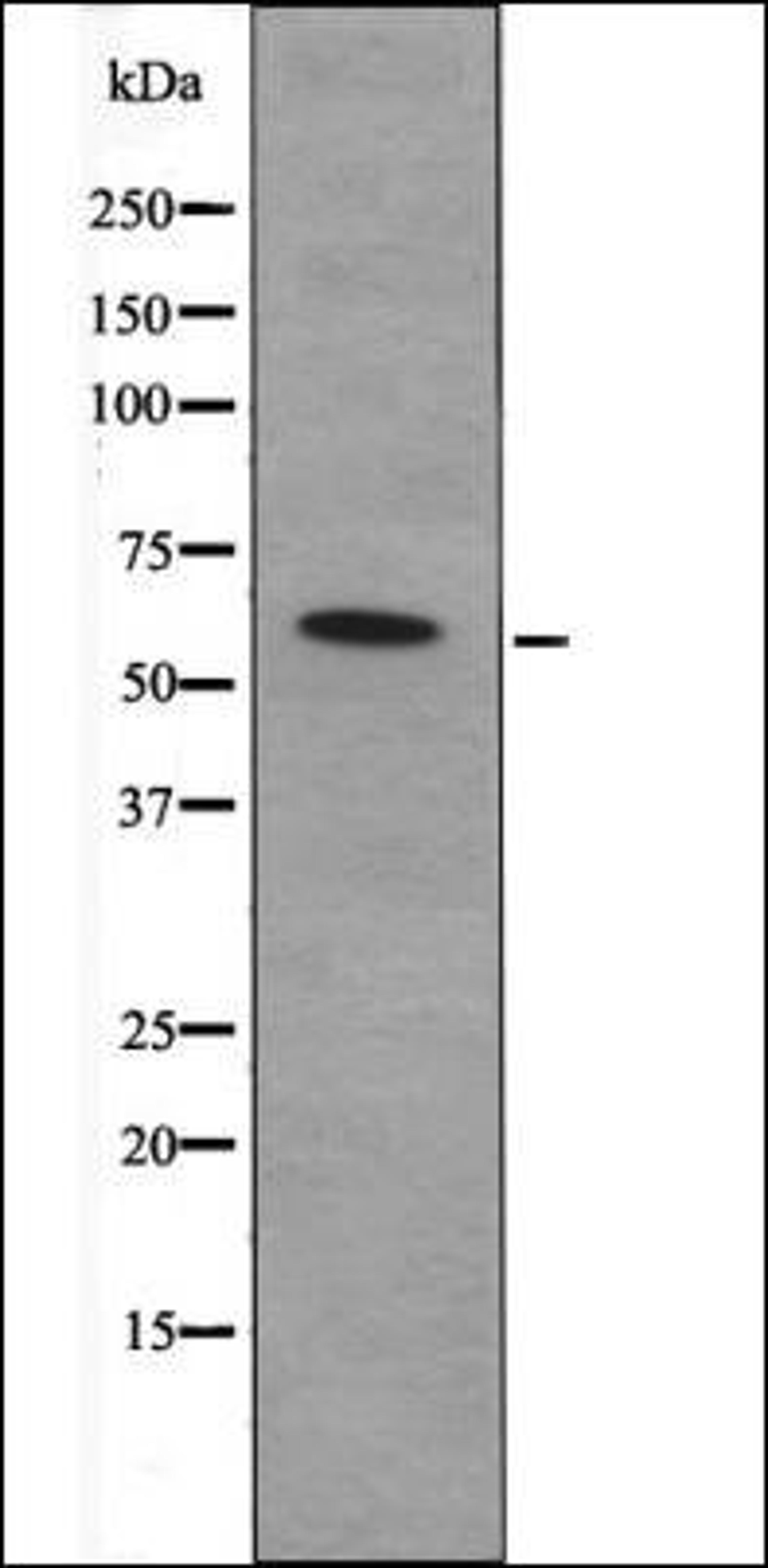 Western blot analysis of Mouse hearttissue lysates using CDC25A -Phospho-Ser82- antibody