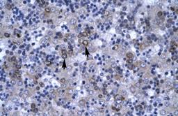 Antibody used in IHC on Human Liver.