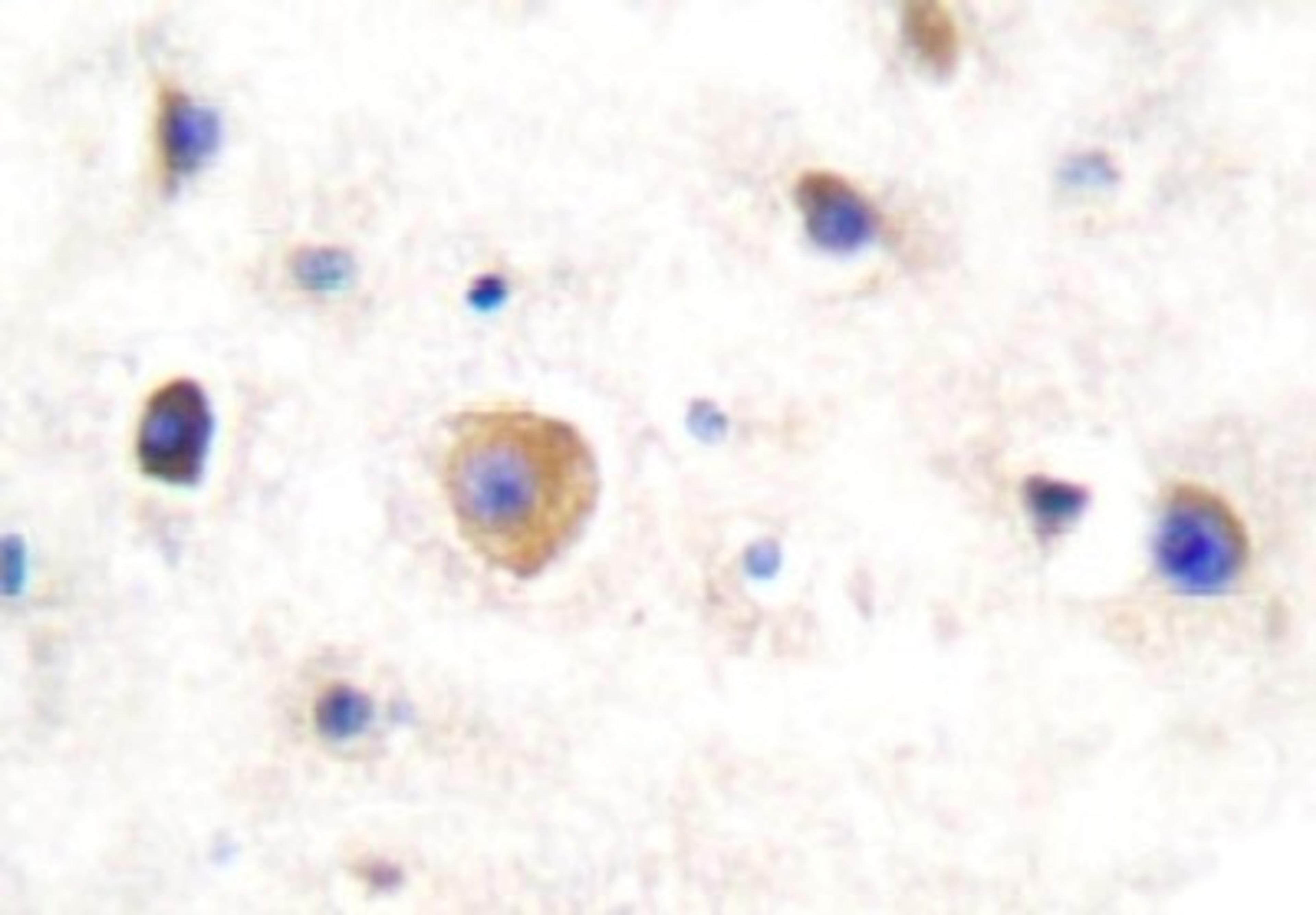 Immunohistochemistry-Paraffin: Connexin 43/GJA1 Antibody [NB100-91717] - Paraffin-embedded human breast tissue.