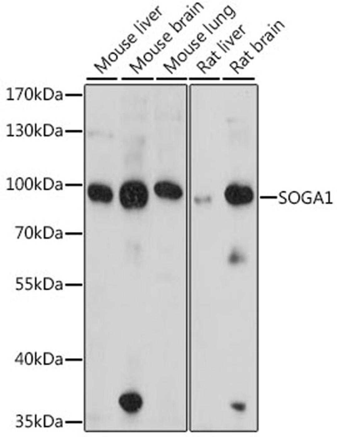 Western blot - SOGA1 antibody (A16597)