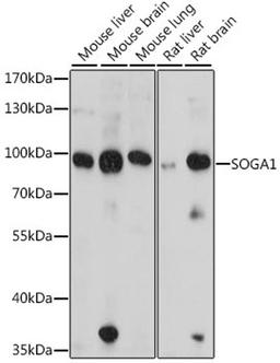 Western blot - SOGA1 antibody (A16597)