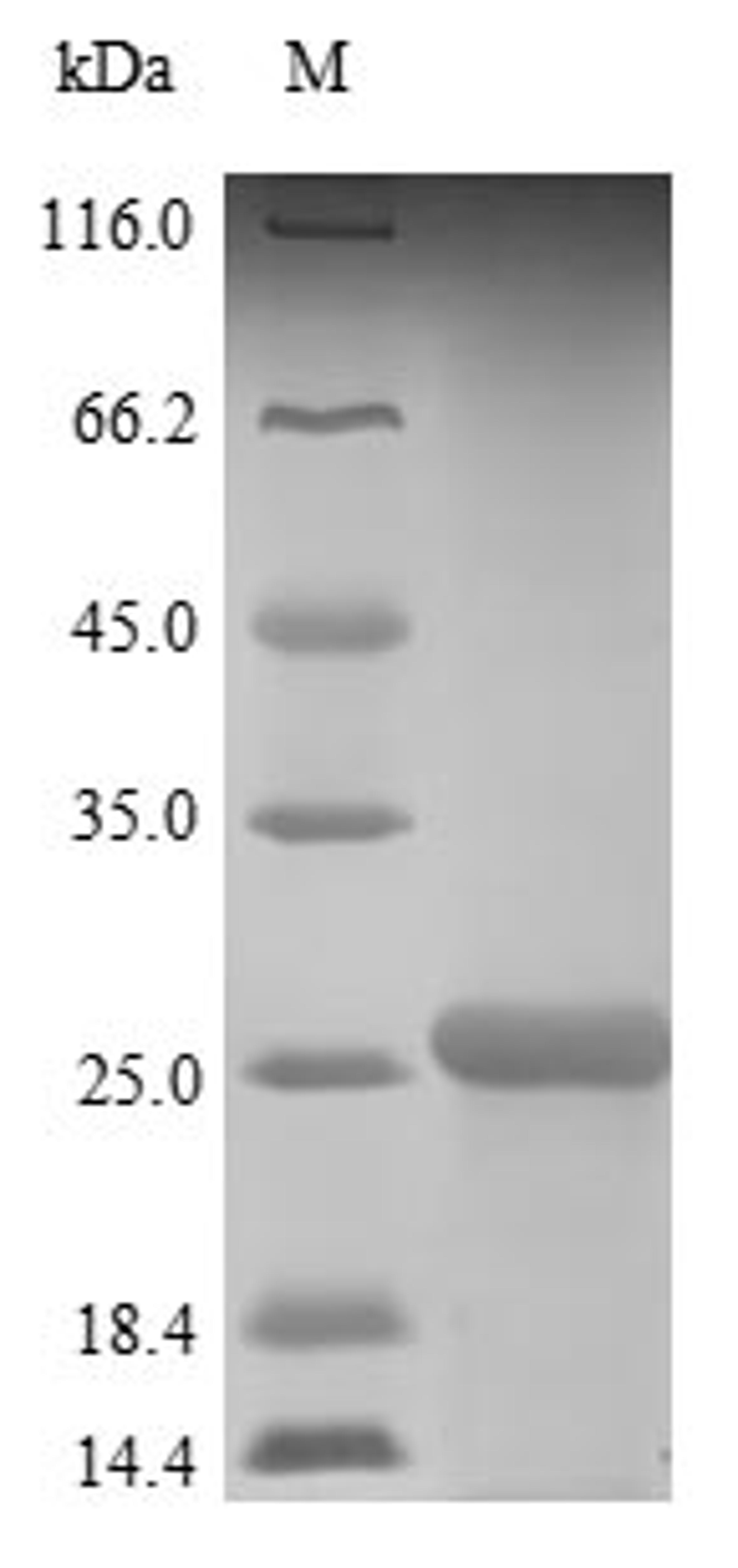 (Tris-Glycine gel) Discontinuous SDS-PAGE (reduced) with 5% enrichment gel and 15% separation gel.