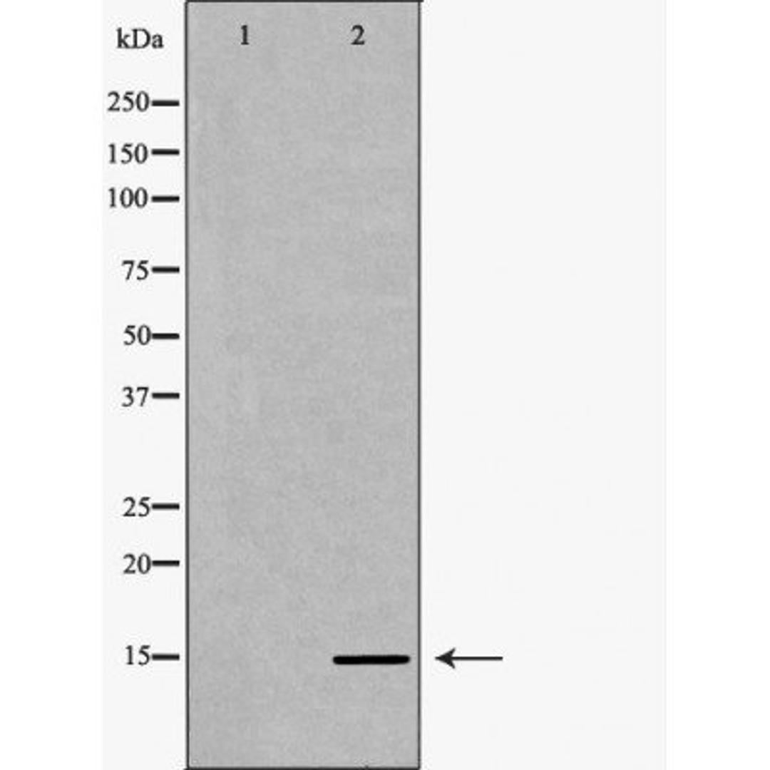 Western blot analysis of HeLa cell line and H3 protein expressed in E.coli using Histone H3K36me1 antibody