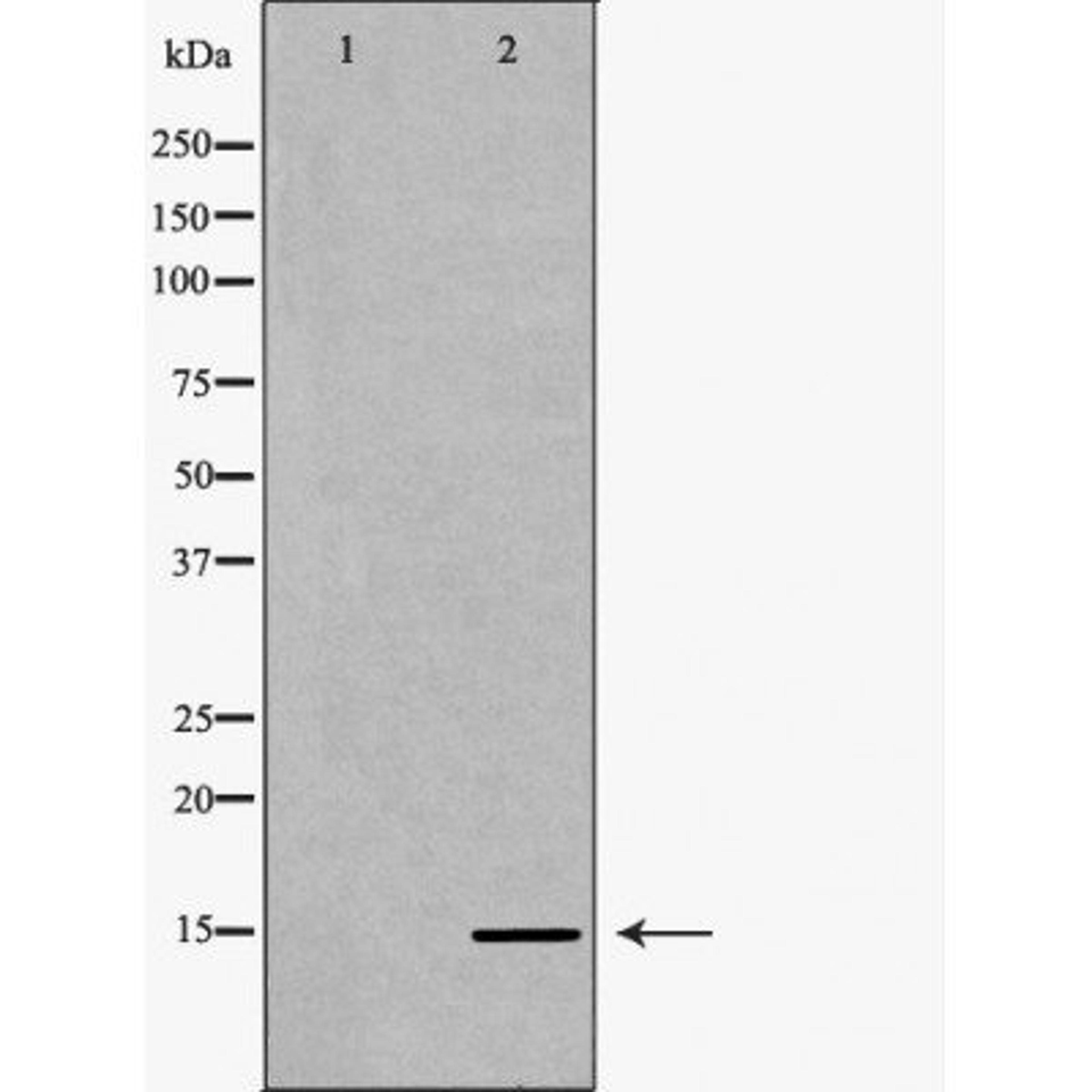 Western blot analysis of HeLa cell line and H3 protein expressed in E.coli using Histone H3K36me1 antibody