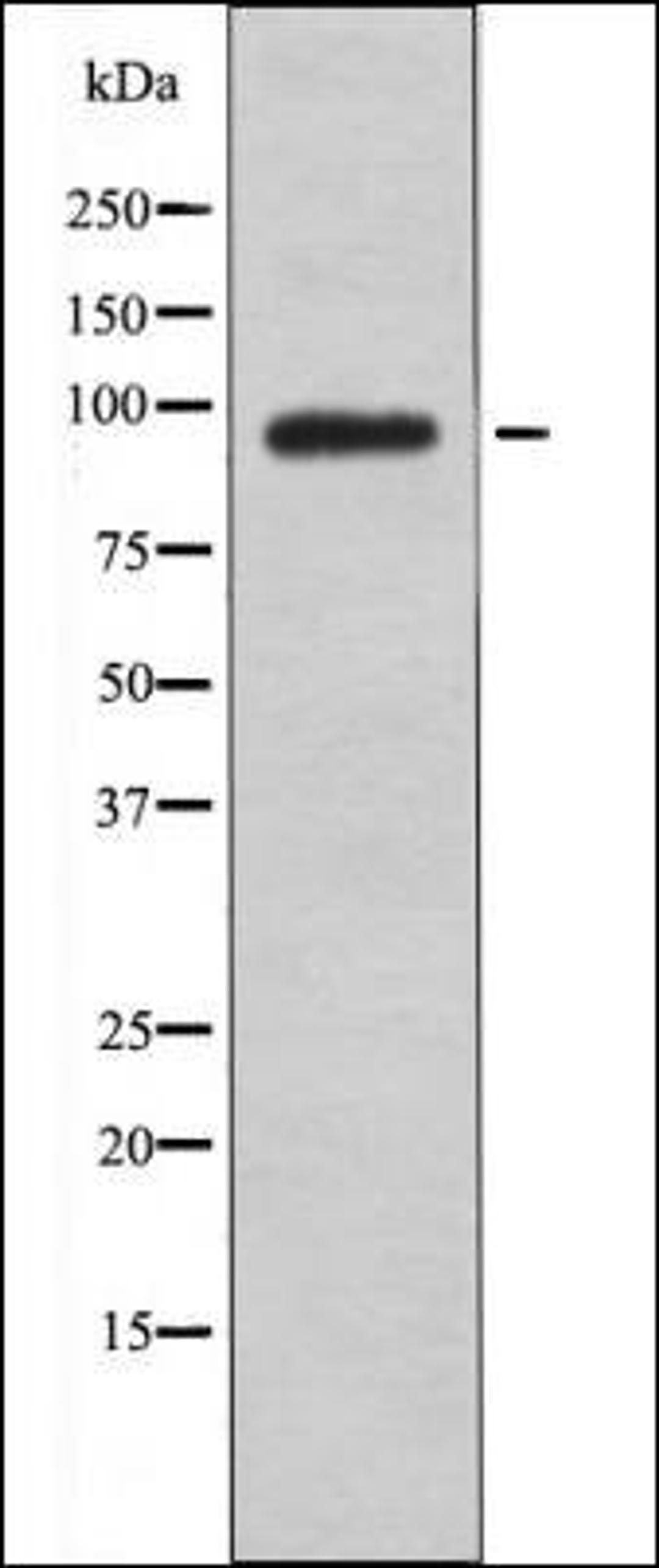 Western blot analysis of COS7 whole cell lysates using FGFR1/2/3/4 -Phospho-Tyr653+Tyr654- antibody