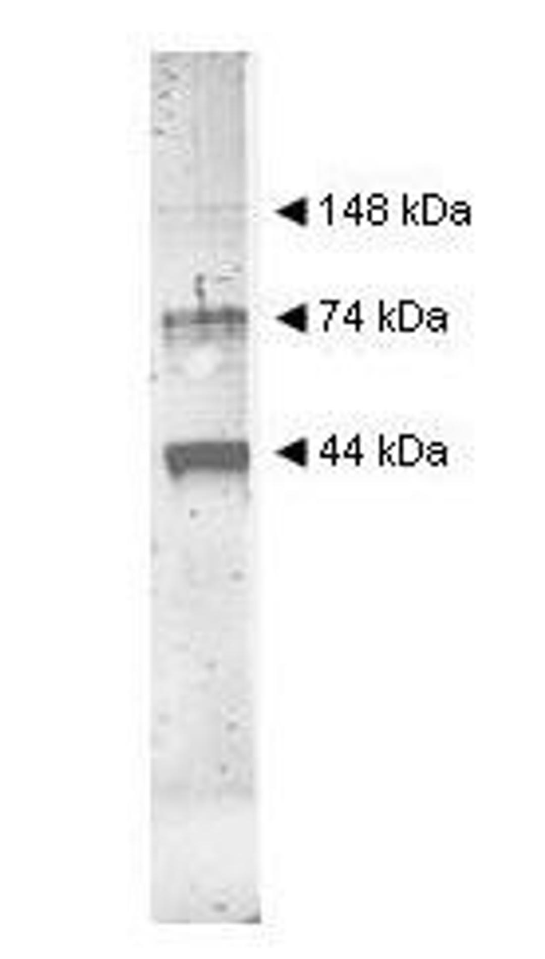 Western blot analysis of used to detect yeast Alcohol Dehydrogenase. Comparison to molecular weight markers (not shown) indicates estimated molecular weights consistent with monomer, dimer and tetramer present in this preparation using Alcohol Dehydrogena