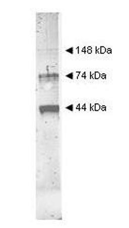 Western blot analysis of used to detect yeast Alcohol Dehydrogenase. Comparison to molecular weight markers (not shown) indicates estimated molecular weights consistent with monomer, dimer and tetramer present in this preparation using Alcohol Dehydrogena