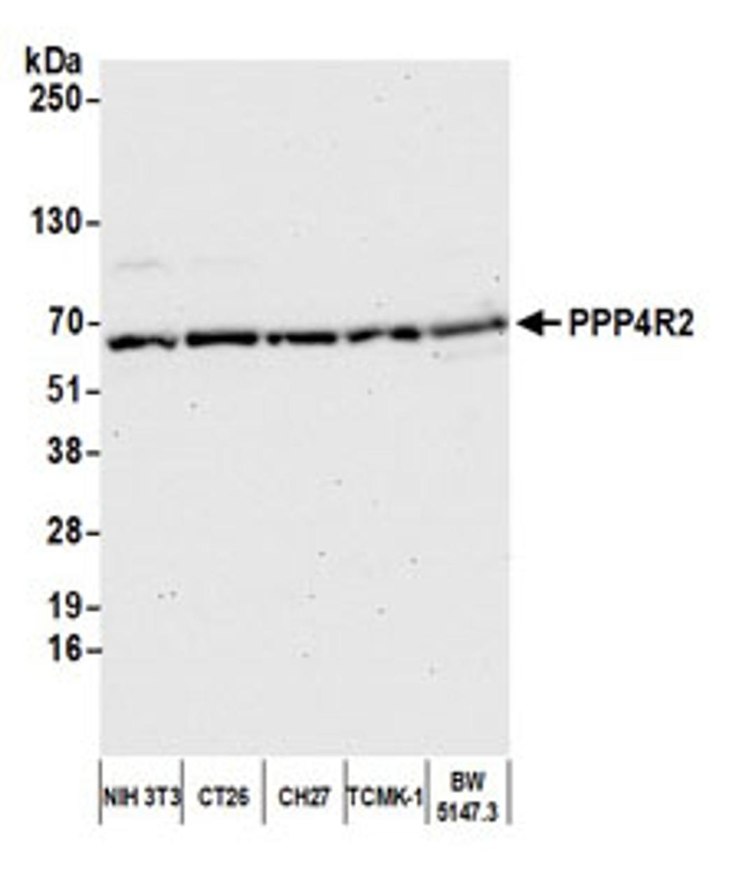 Detection of mouse PPP4R2 by western blot.