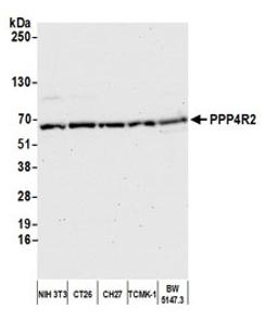 Detection of mouse PPP4R2 by western blot.