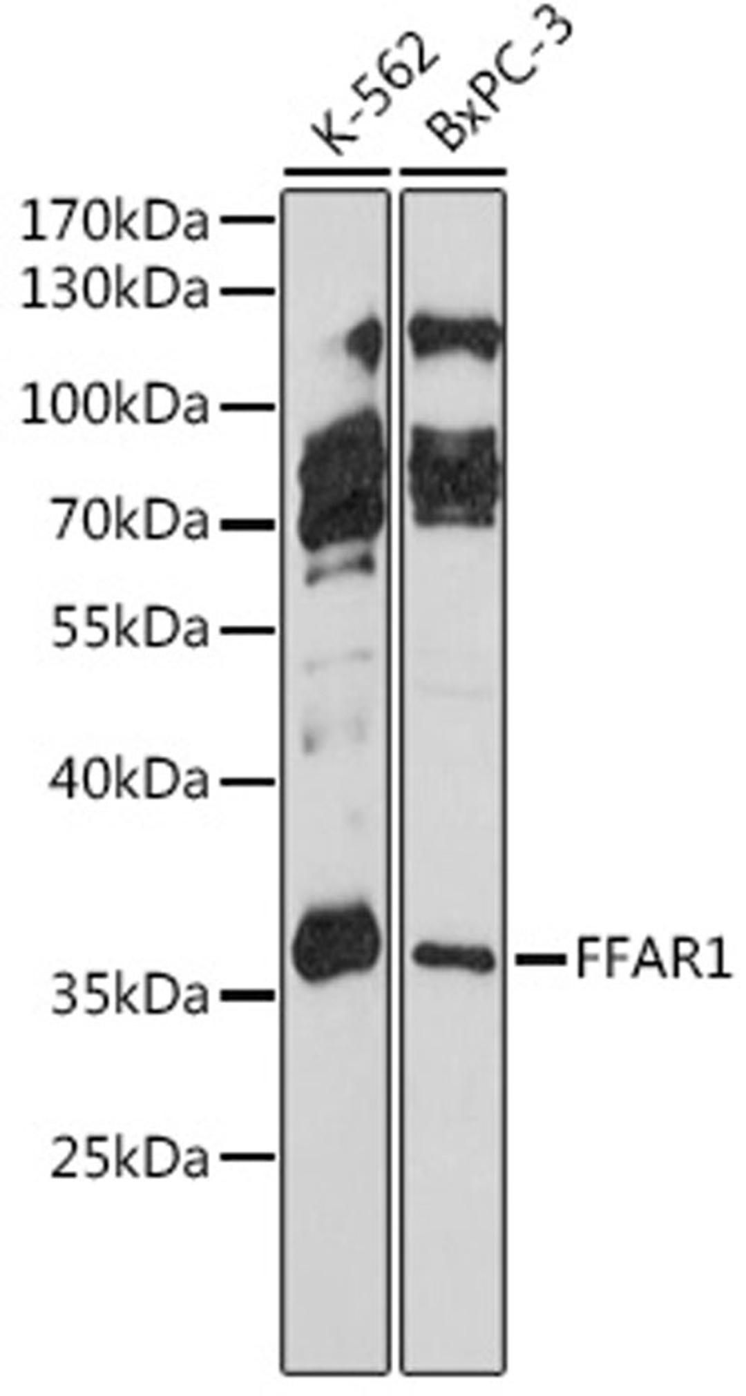 Western blot - FFAR1 antibody (A16379)