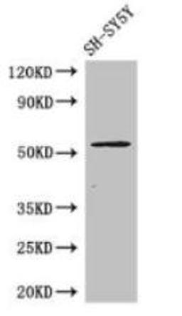 Western Blot. Positive WB detected in: SH-SY5Y whole cell lysate. All lanes: METTL14 antibody at 1:1000. Secondary. Goat polyclonal to rabbit IgG at 1/50000 dilution Predicted band size: 53 kDa. Observed band size: 53 kDa.