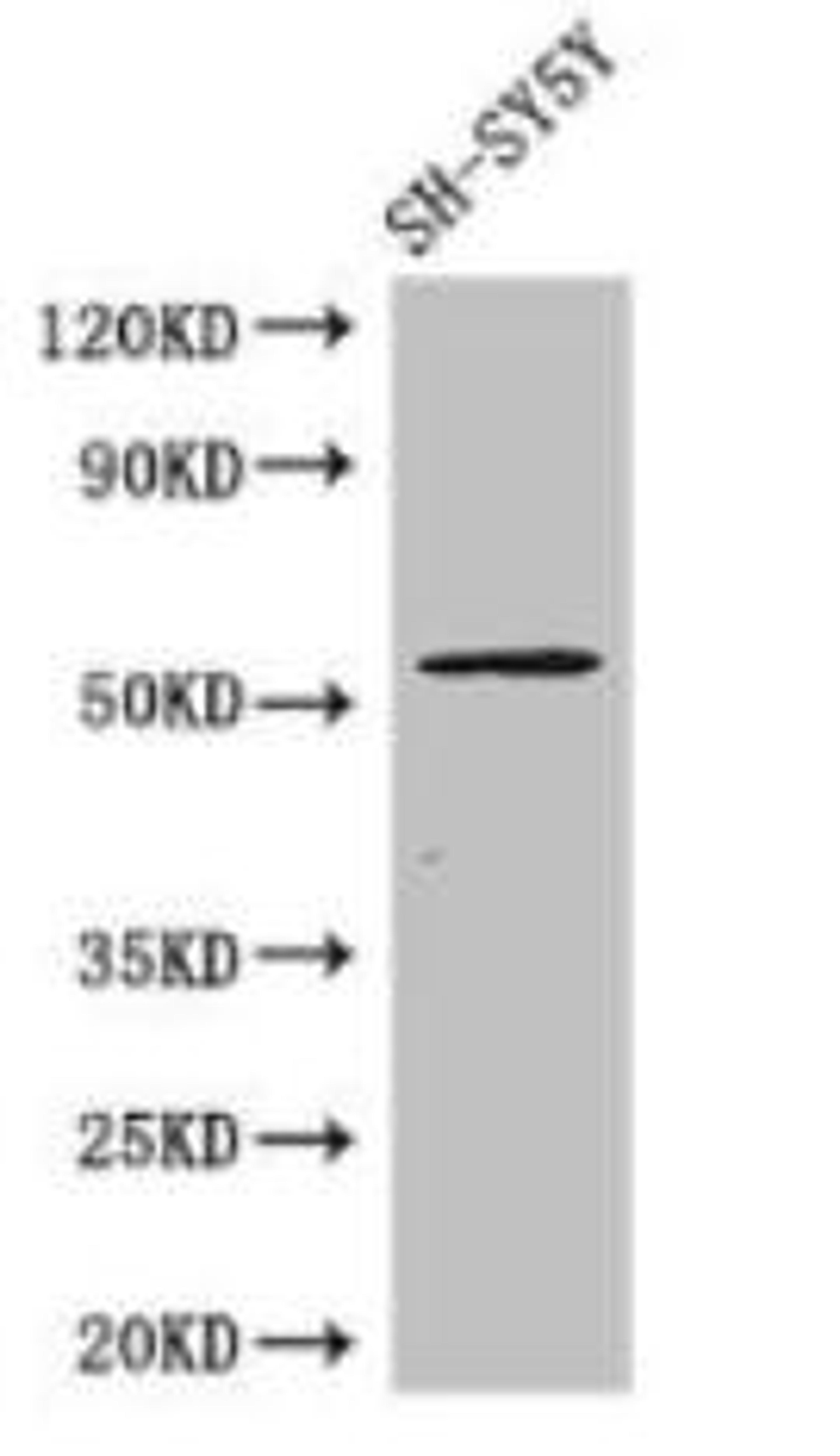 Western Blot. Positive WB detected in: SH-SY5Y whole cell lysate. All lanes: METTL14 antibody at 1:1000. Secondary. Goat polyclonal to rabbit IgG at 1/50000 dilution Predicted band size: 53 kDa. Observed band size: 53 kDa.