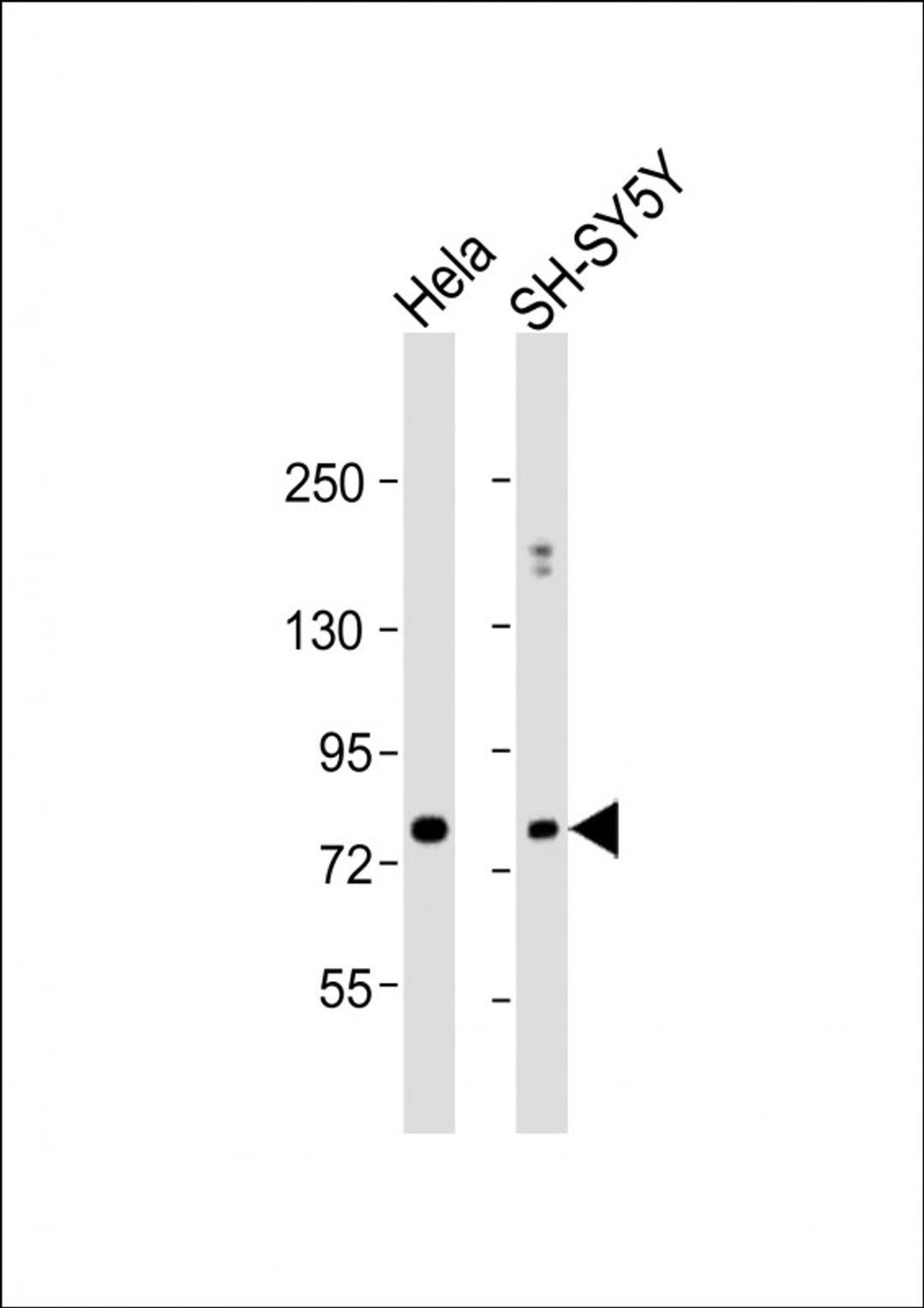 Western Blot at 1:1000 dilution Lane 1: Hela whole cell lysate Lane 2: SH-SY5Y whole cell lysate Lysates/proteins at 20 ug per lane.