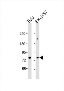 Western Blot at 1:1000 dilution Lane 1: Hela whole cell lysate Lane 2: SH-SY5Y whole cell lysate Lysates/proteins at 20 ug per lane.