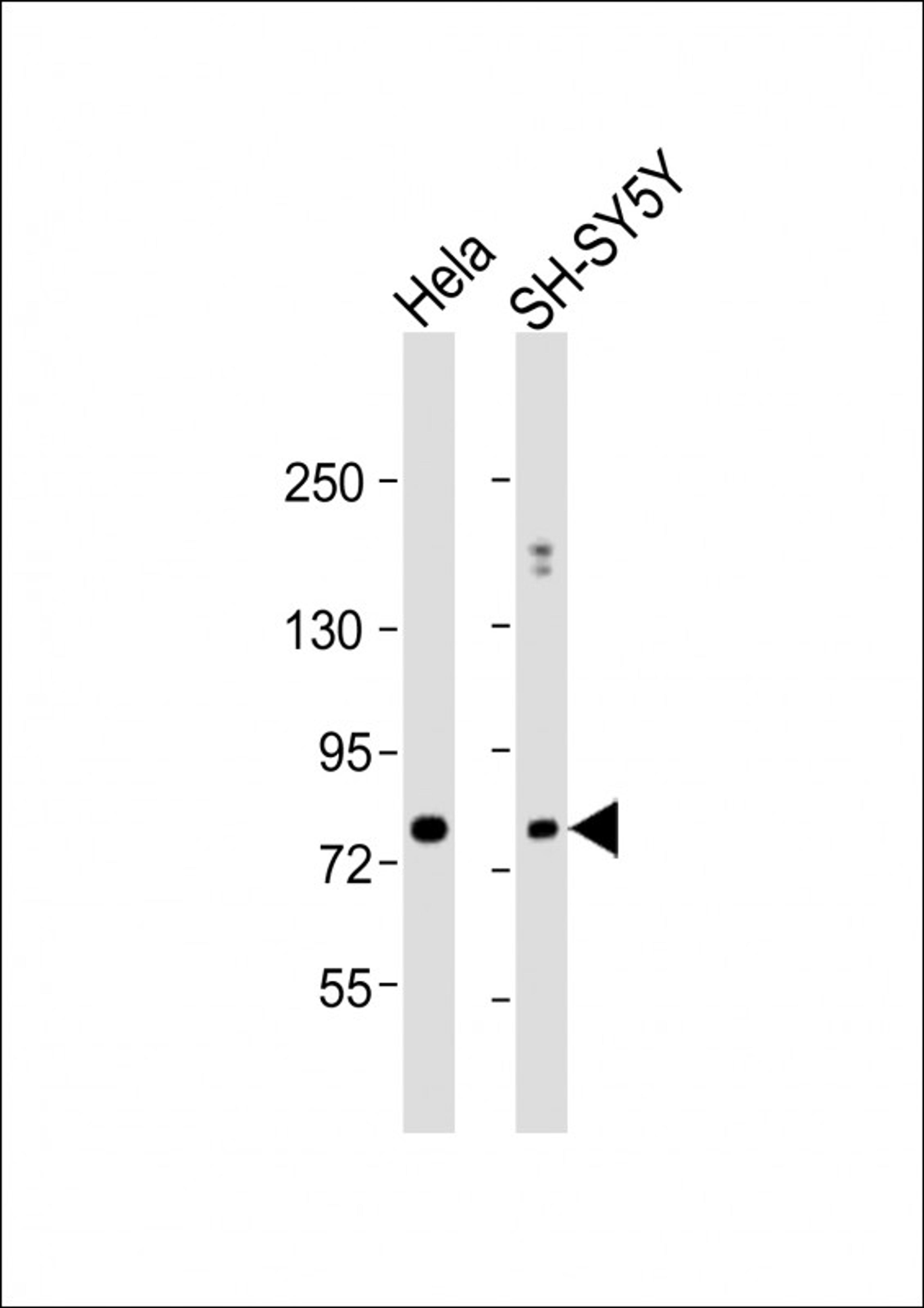 Western Blot at 1:1000 dilution Lane 1: Hela whole cell lysate Lane 2: SH-SY5Y whole cell lysate Lysates/proteins at 20 ug per lane.