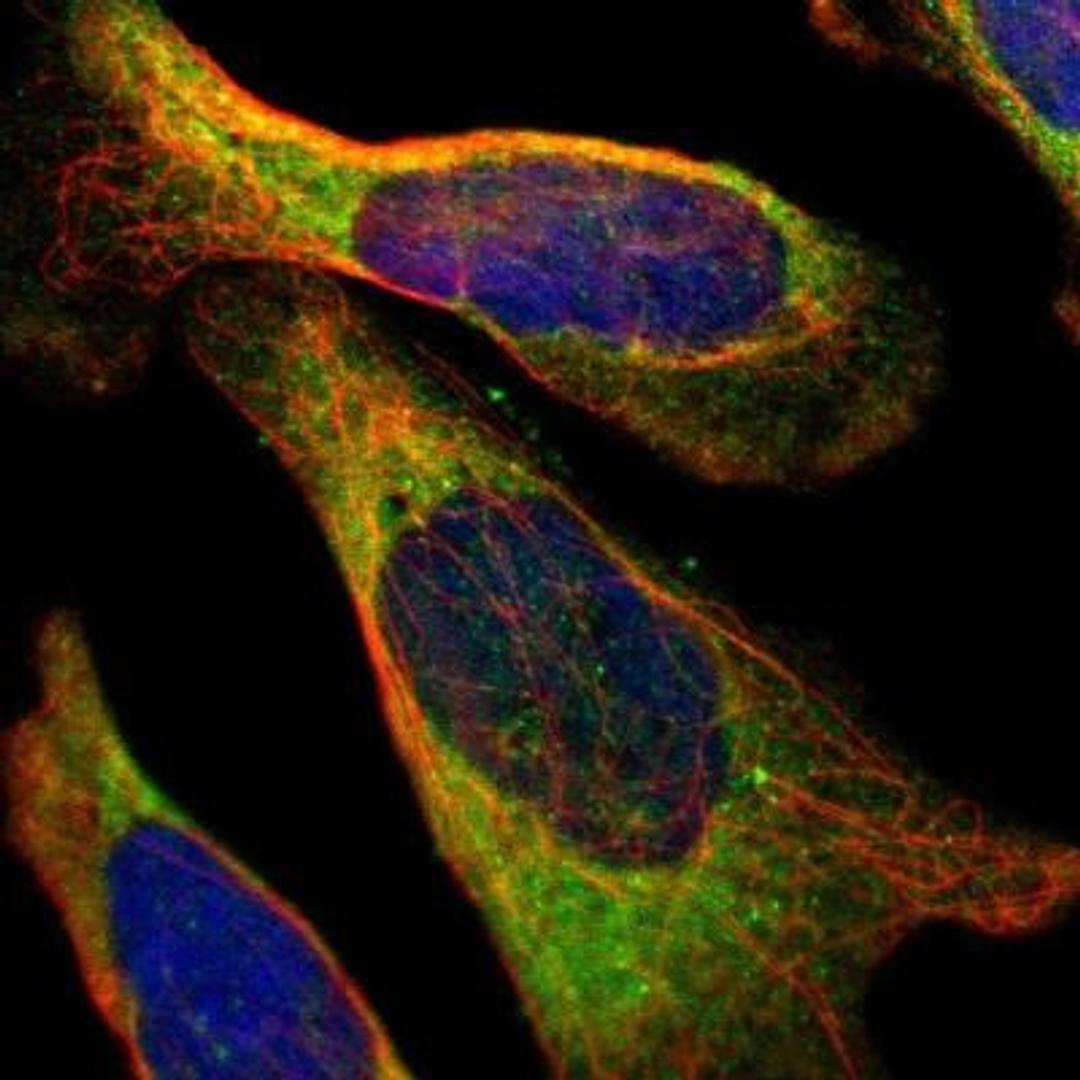 Immunocytochemistry/Immunofluorescence: Muscle Phosphofructokinase/PFKM/PFK-1 Antibody [NBP1-87293] - Staining of human cell line U-2 OS shows positivity in endoplasmic reticulum.